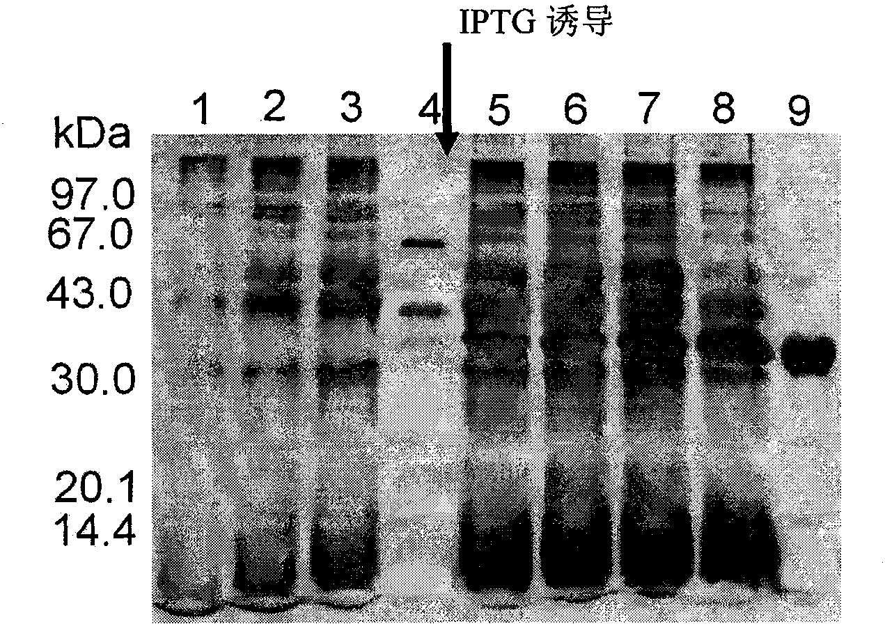 Recombinant human arginase fusion protein and application thereof