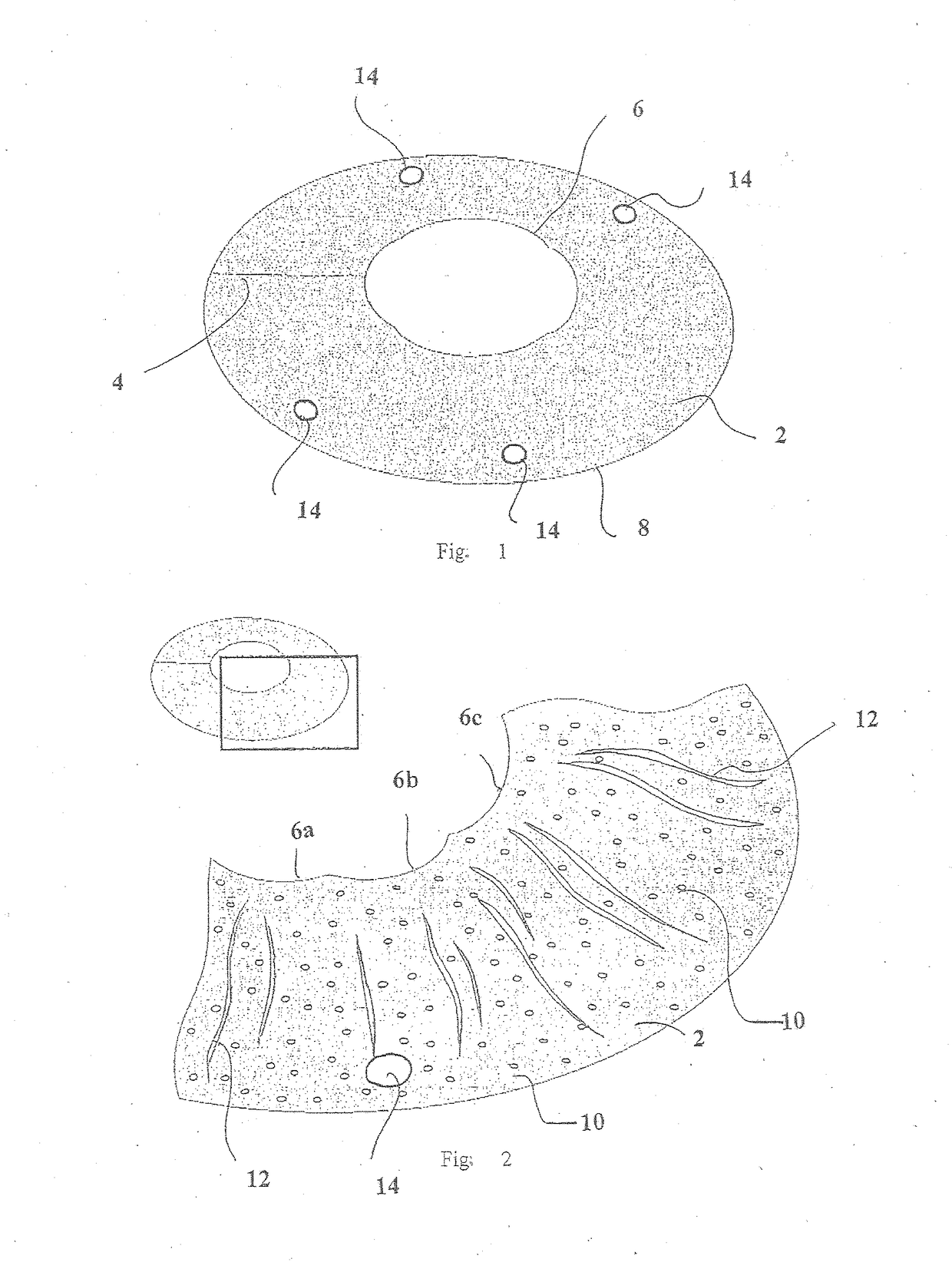 Cosmetic corneal inlay and implantation method thereof