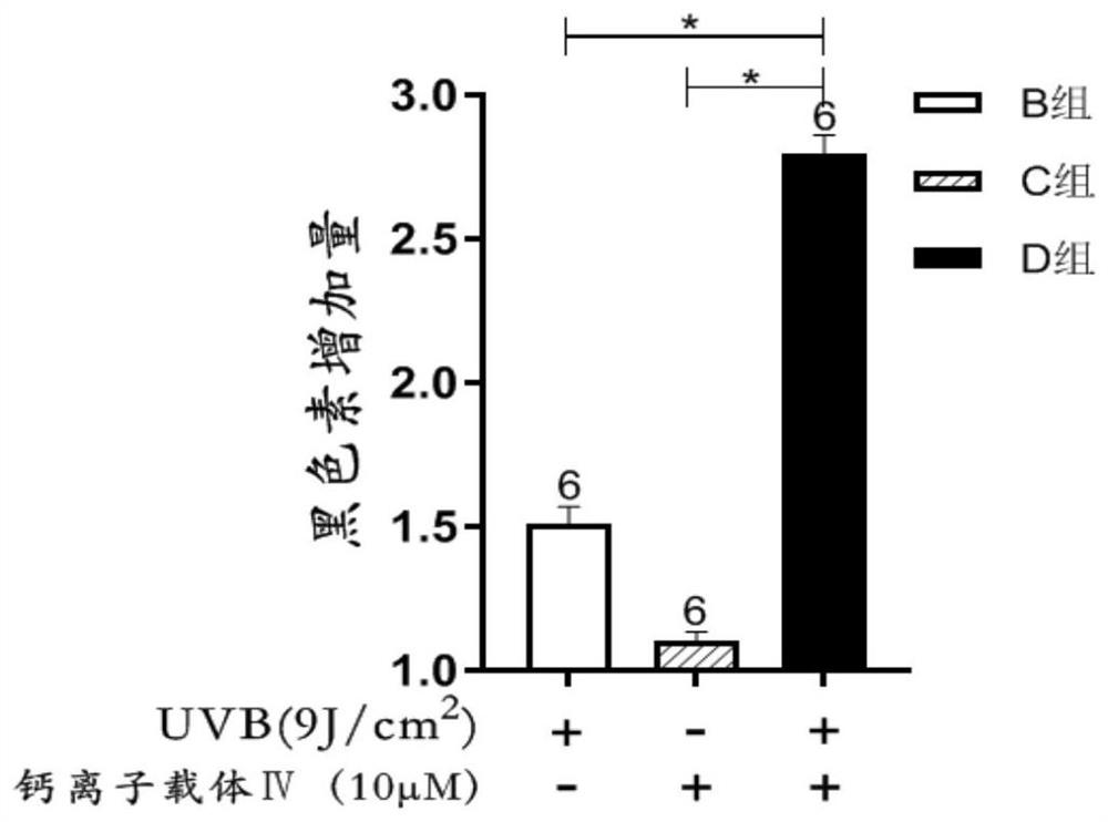 Application of calcium ion carrier in leucoderma treatment