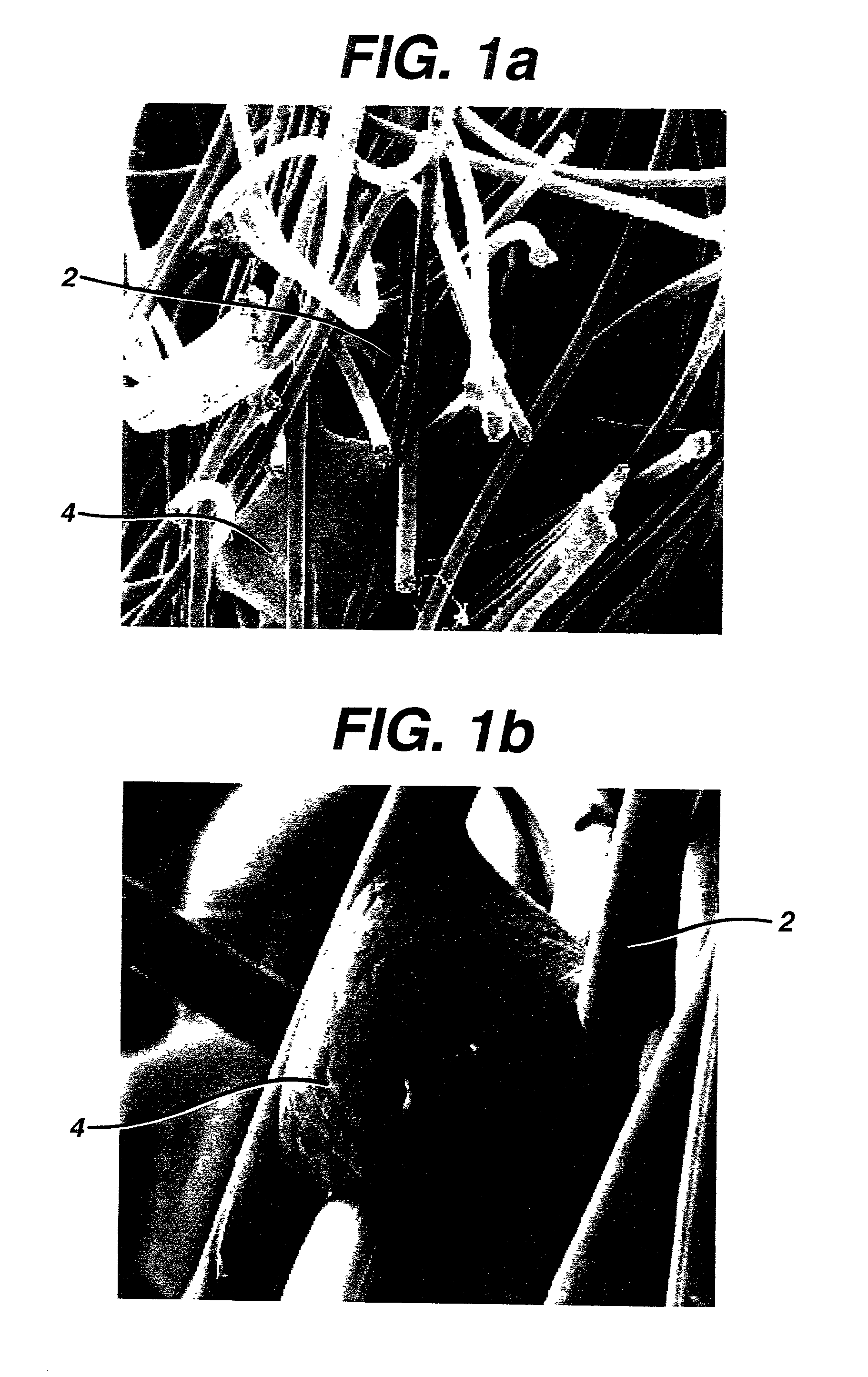 Implantable biodegradable devices for musculoskeletal repair or regeneration