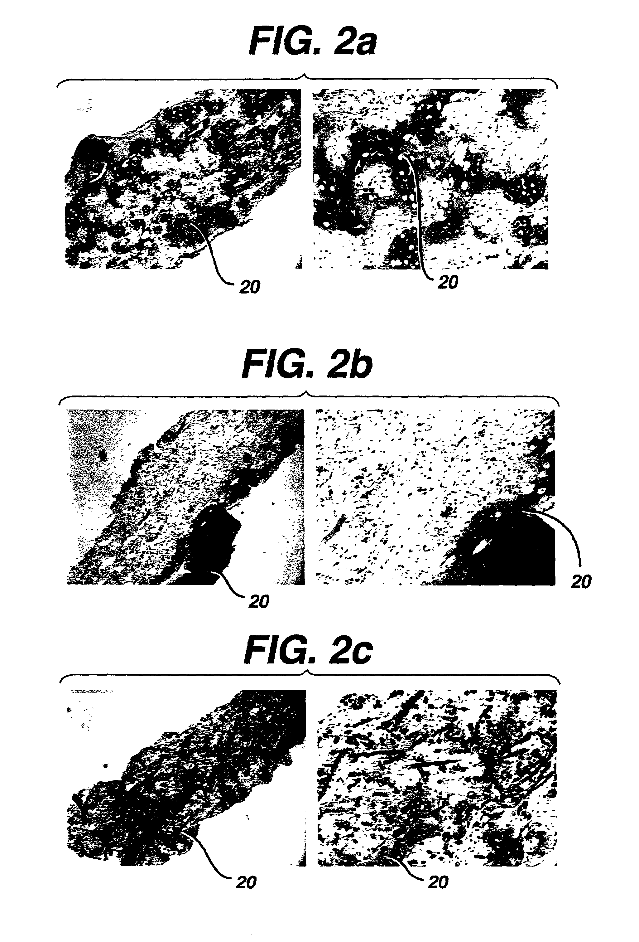 Implantable biodegradable devices for musculoskeletal repair or regeneration