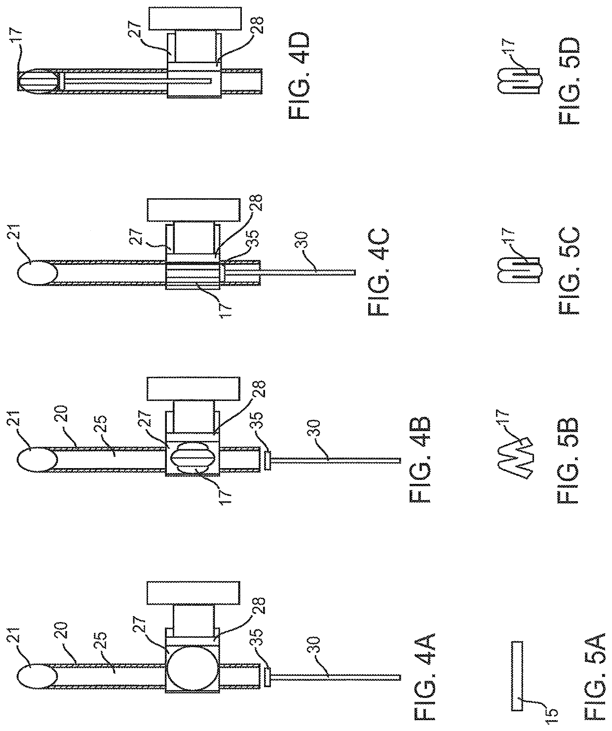 Corneal implants and methods and systems for placement