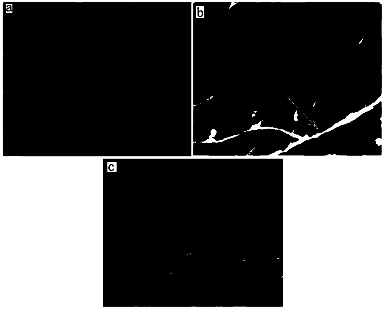 Multifunctional dura mater repairing material based on biomimetic design and preparation method thereof