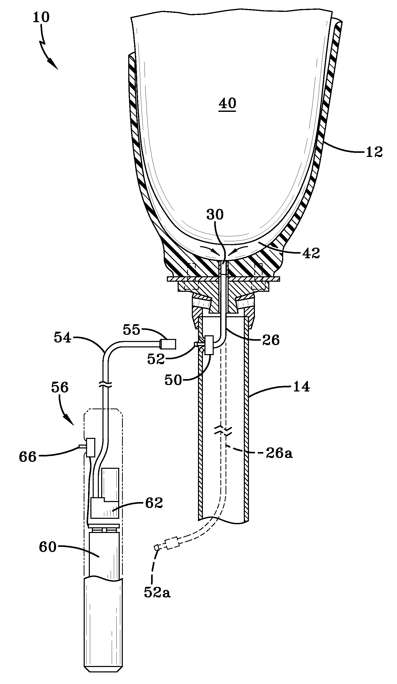 Prosthetic device utilizing electric vacuum pump
