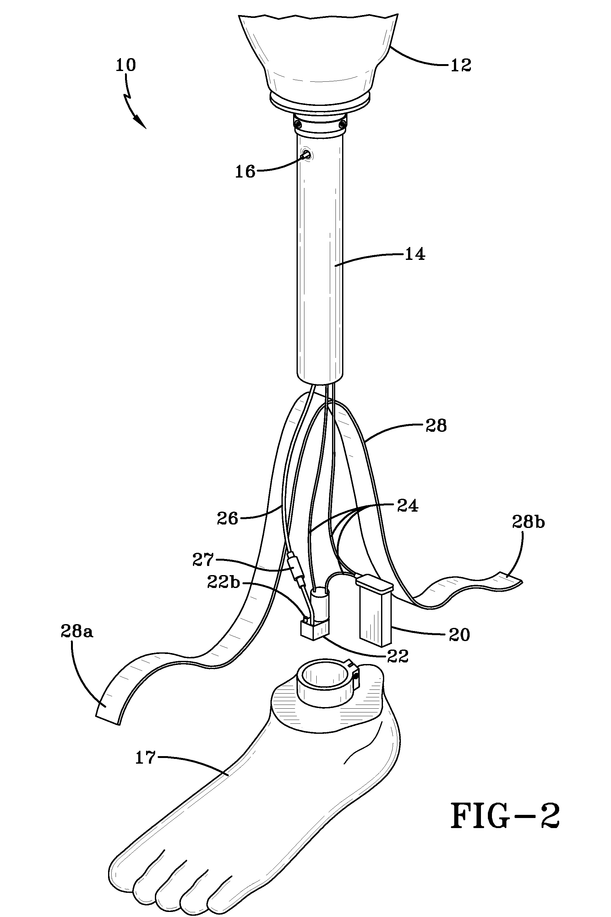 Prosthetic device utilizing electric vacuum pump