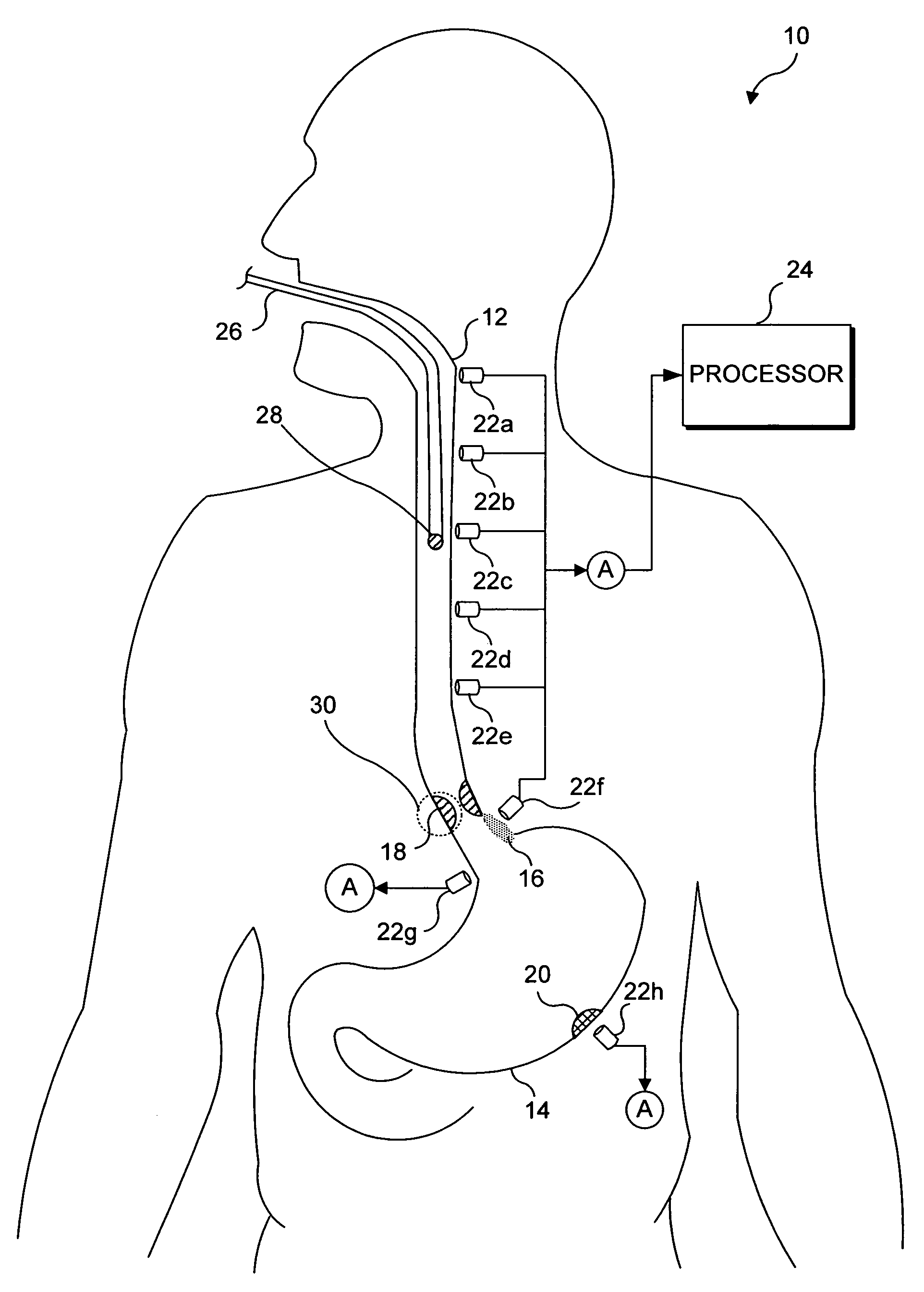 Medical training simulator including contact-less sensors