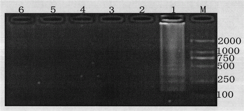 Loop-mediated isothermal amplification-based nucleic acid test method for Riemerella anatipestifer