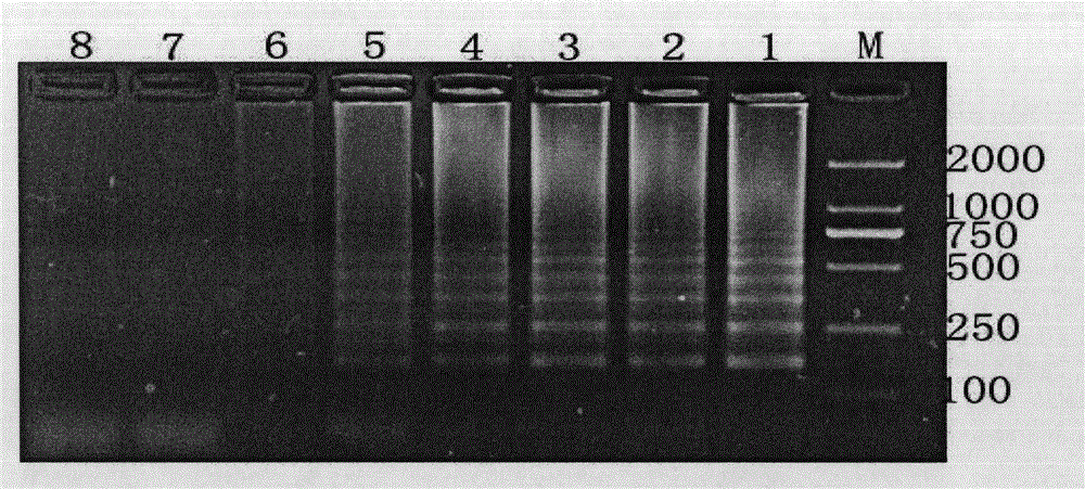 Loop-mediated isothermal amplification-based nucleic acid test method for Riemerella anatipestifer