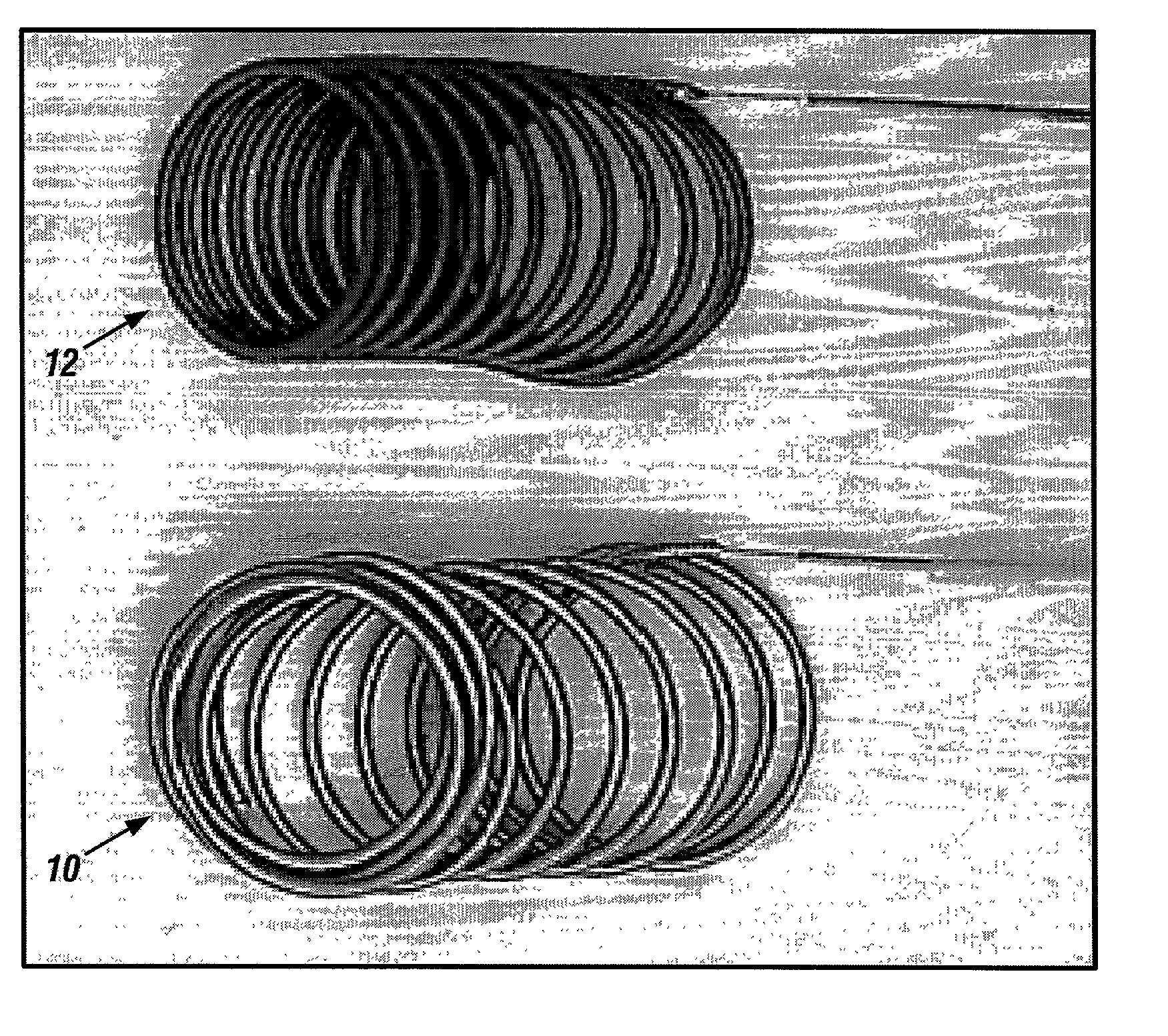 Bioabsorbable polymeric implants and a method of using the same to create occlusions