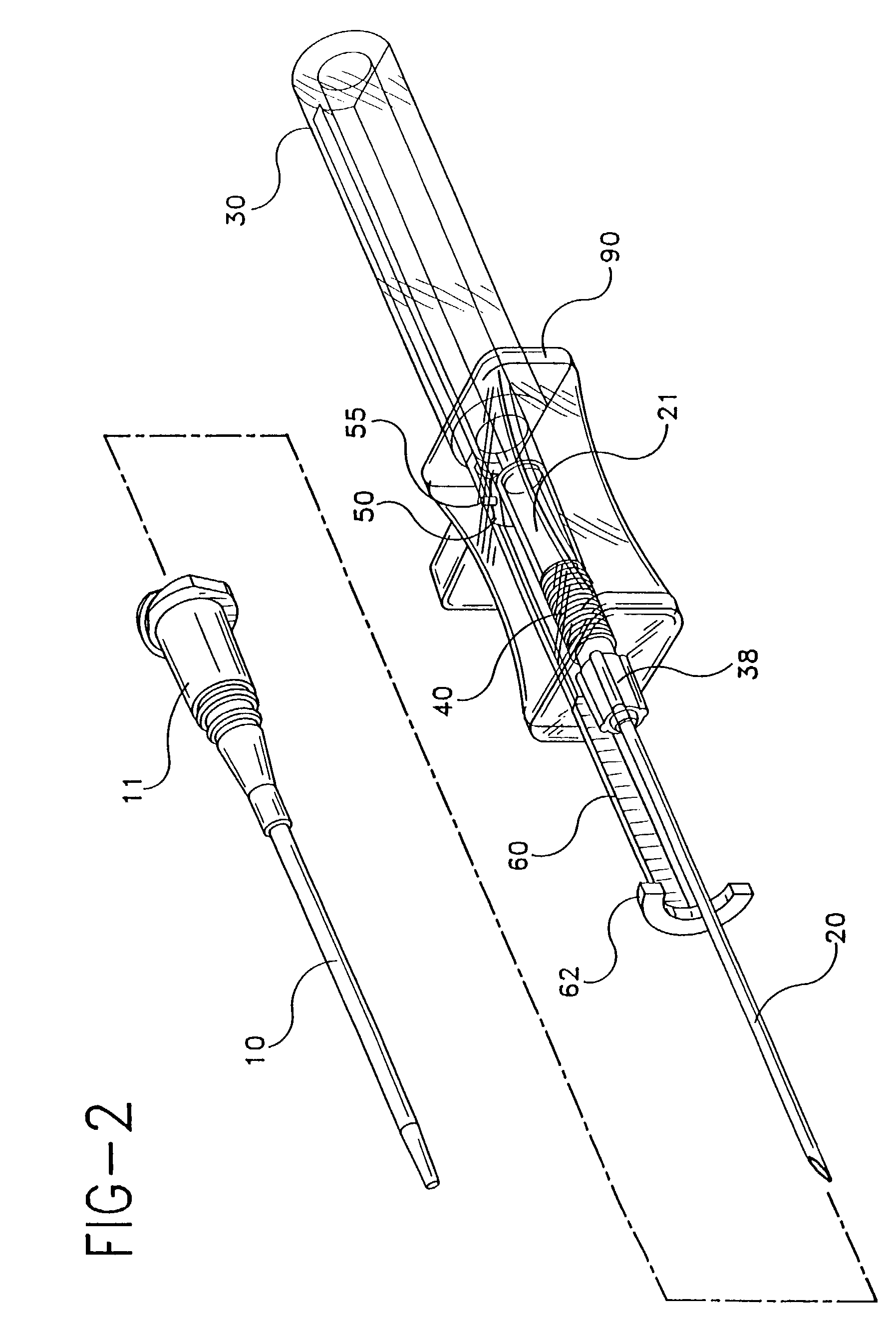 Catheter-advancement actuated needle retraction system