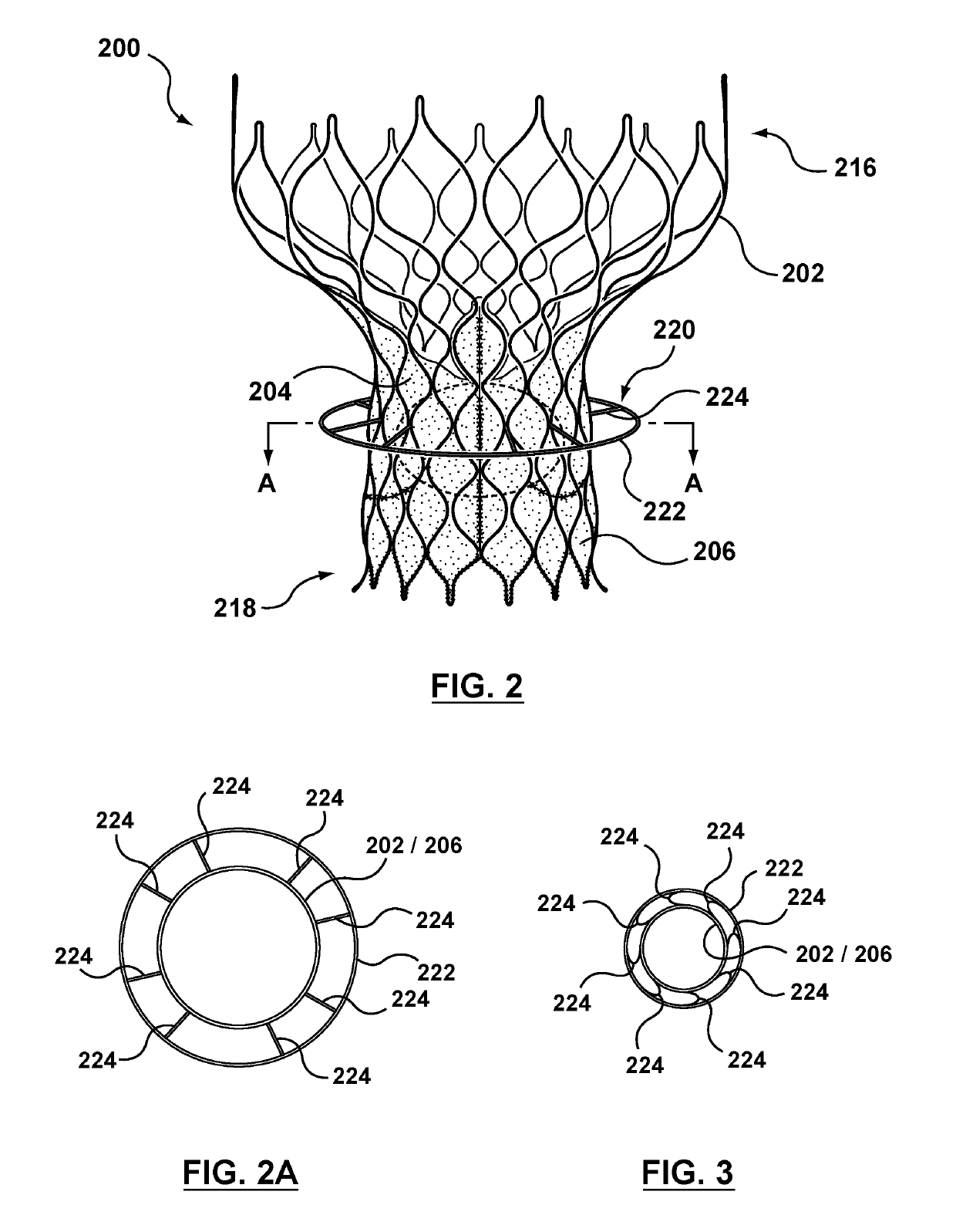 Valve prostheses having an integral centering mechanism and methods of use thereof