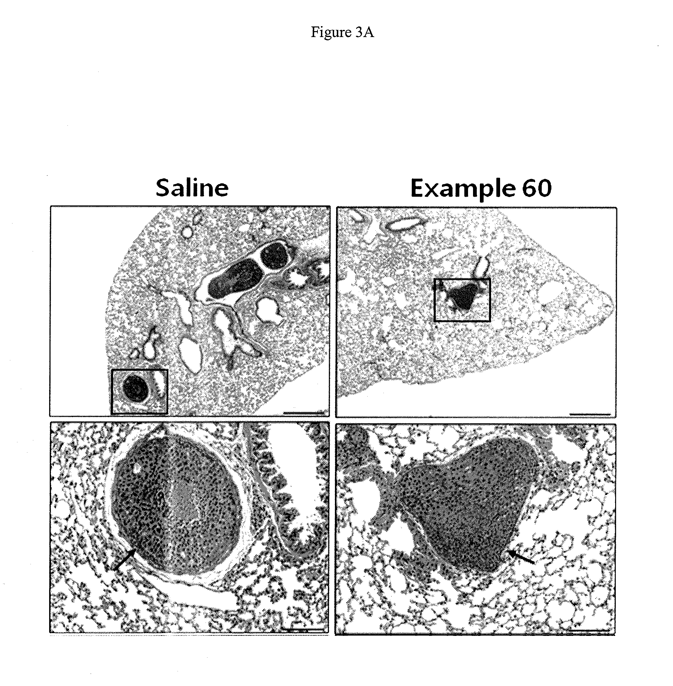 2-pyridyl substituted imidazoles as therapeutic alk5 and/or alk4 inhibitors