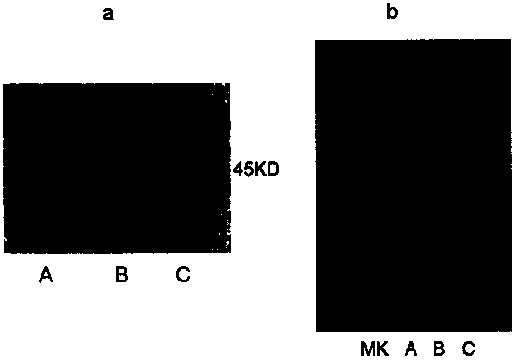 A kind of serum cenpf antibody quantitative detection kit