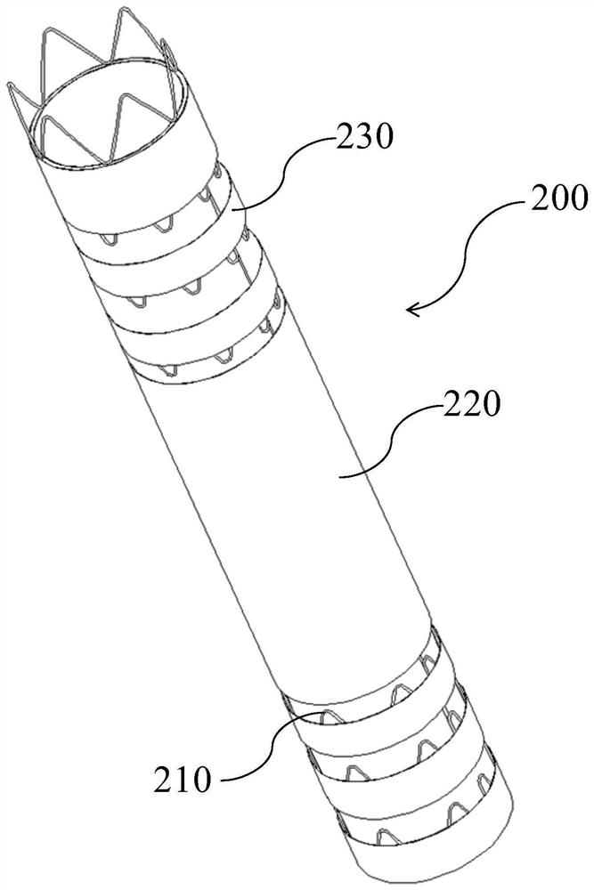 Covered stent