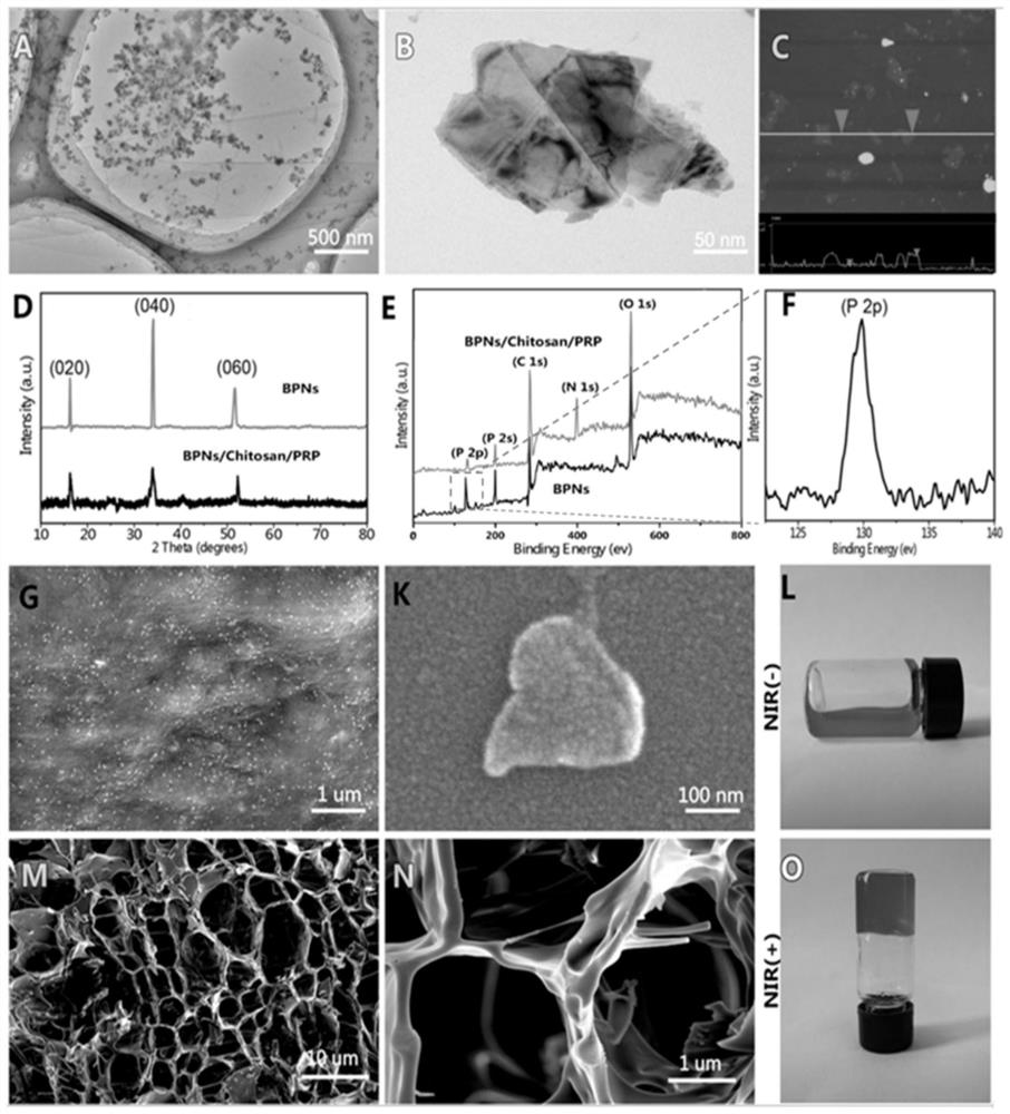 A kind of bpns/chitosan/prp thermosensitive hydrogel and its preparation method and application