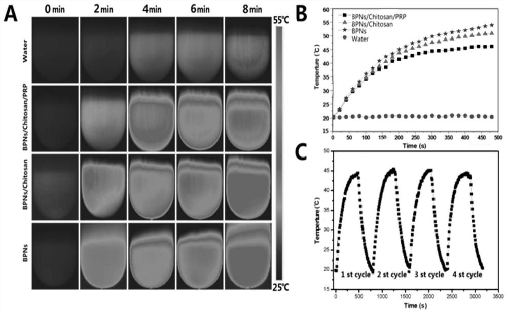 A kind of bpns/chitosan/prp thermosensitive hydrogel and its preparation method and application