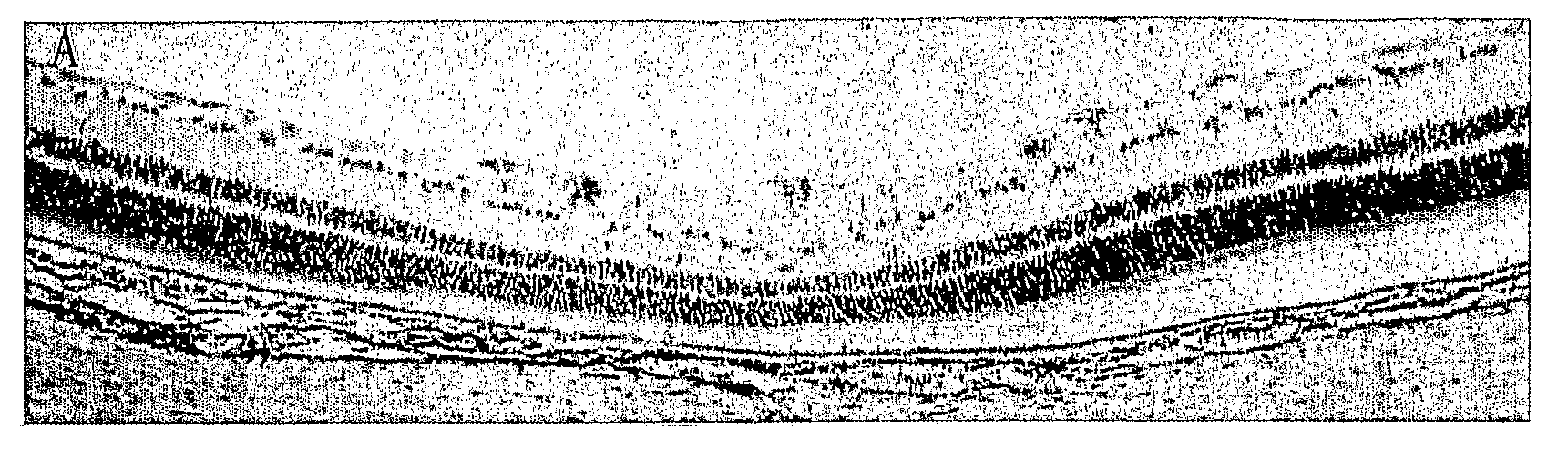 Staining Composition For Staining An Ophthalmic Membrane