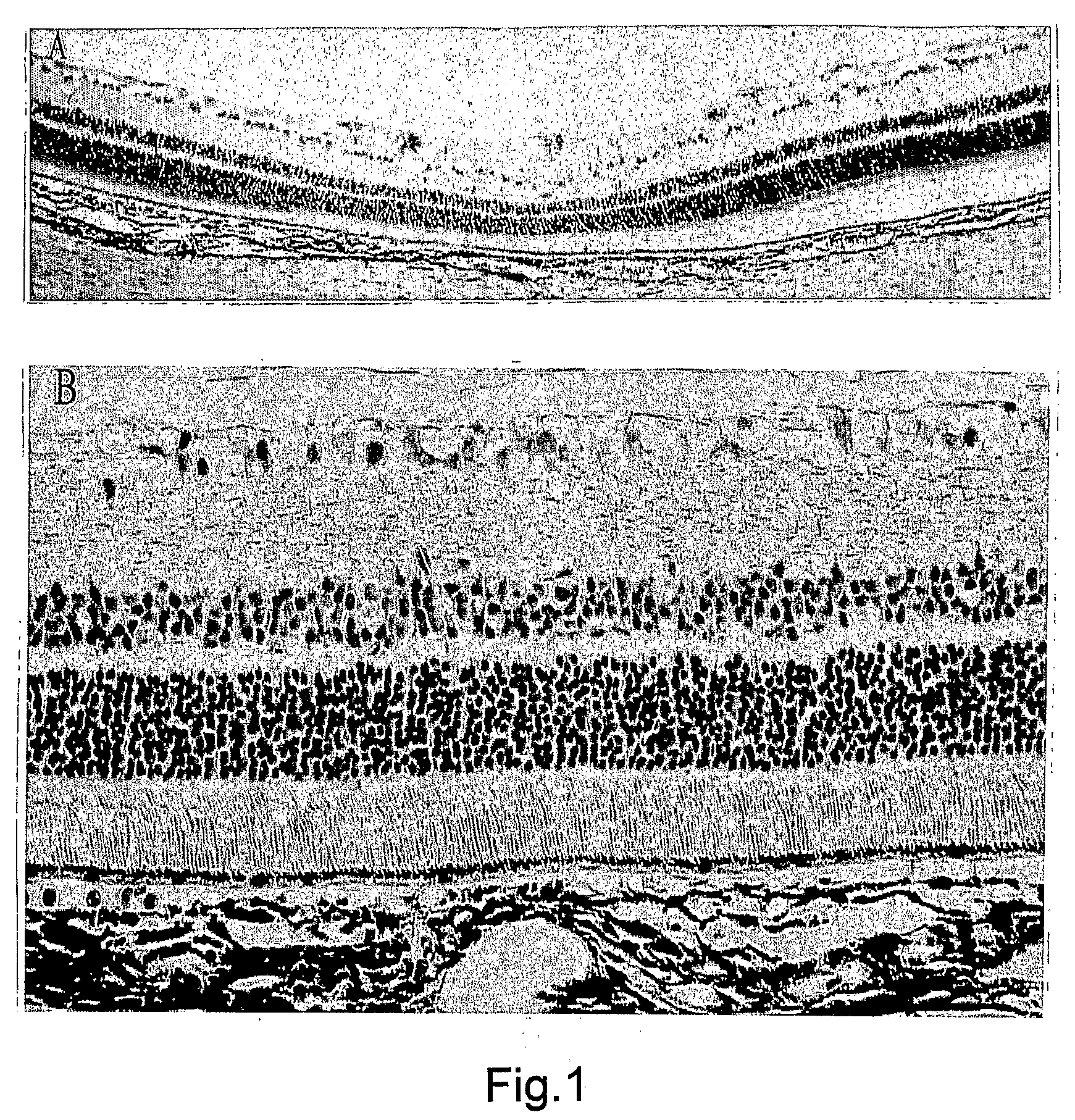 Staining Composition For Staining An Ophthalmic Membrane