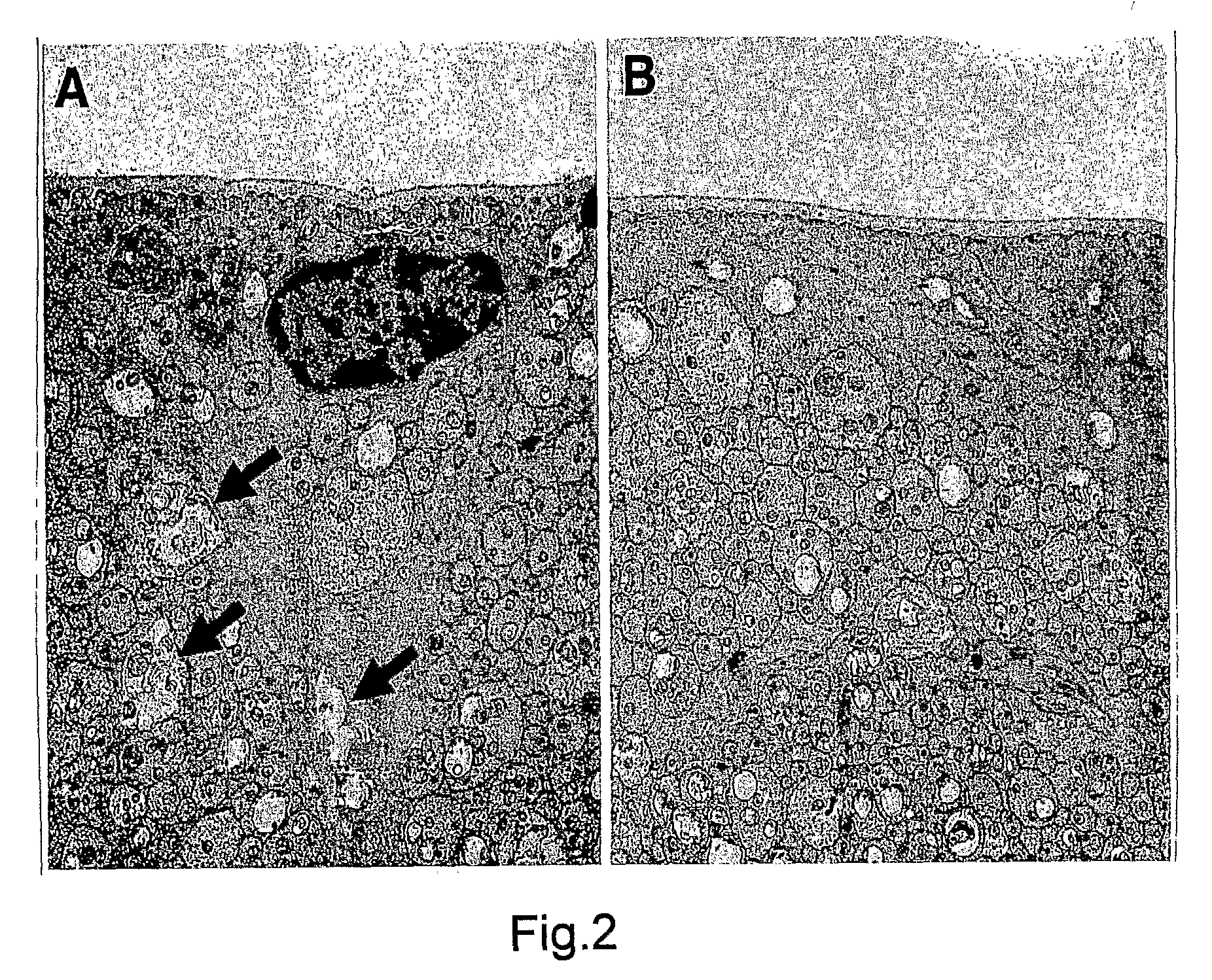 Staining Composition For Staining An Ophthalmic Membrane