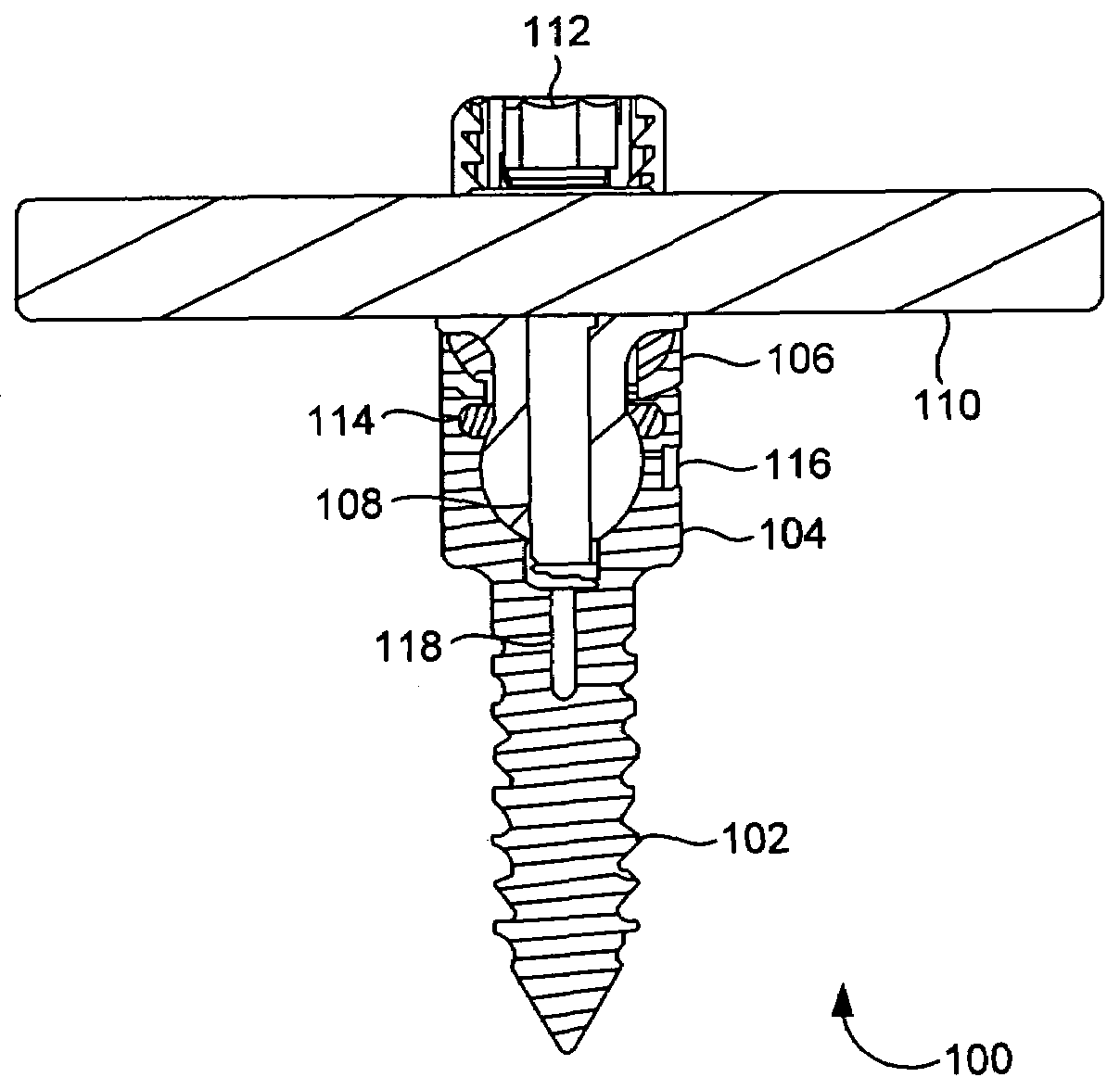 Sealed Lubrication System and Method for Dynamic Stabilization System