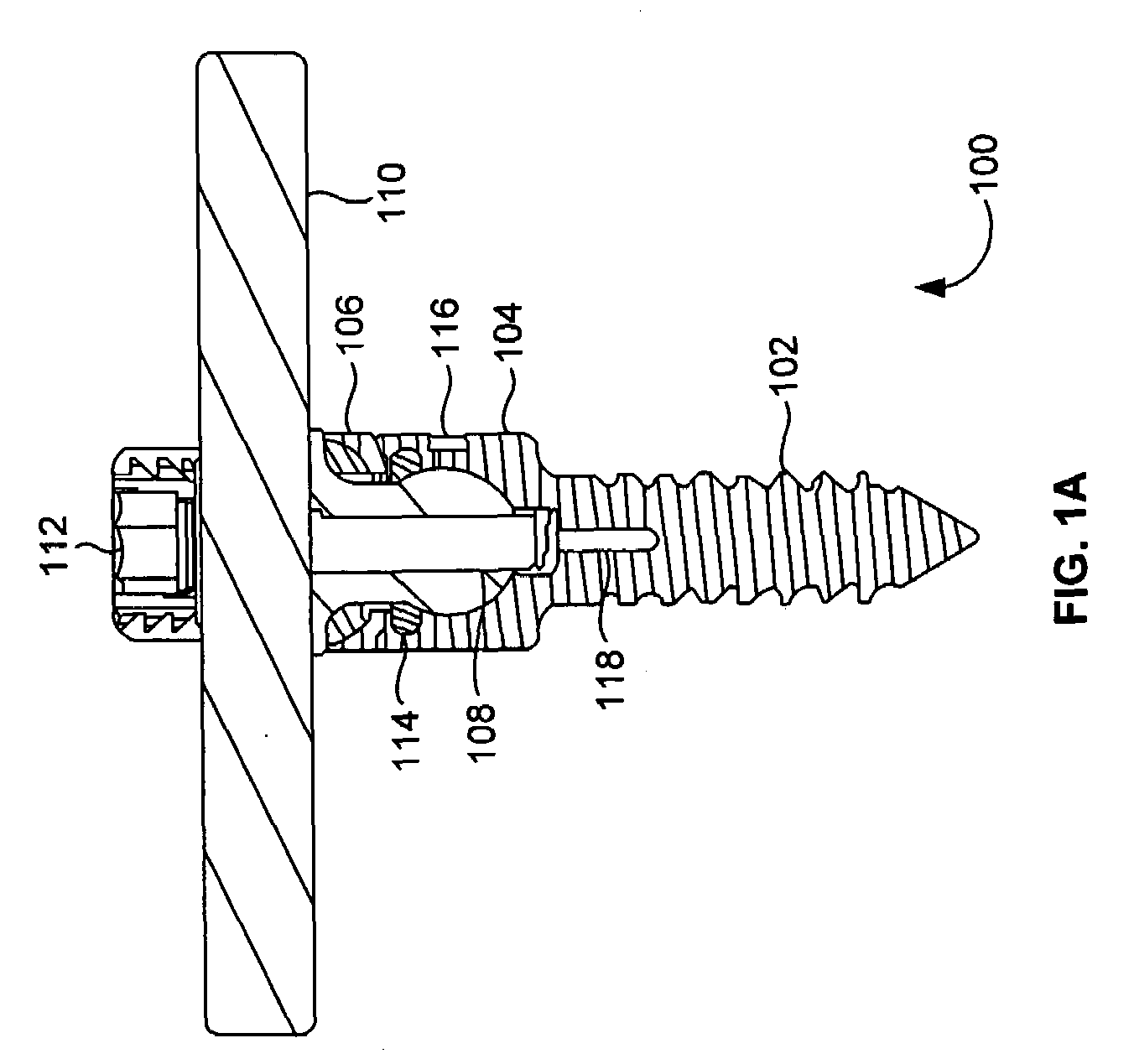 Sealed Lubrication System and Method for Dynamic Stabilization System