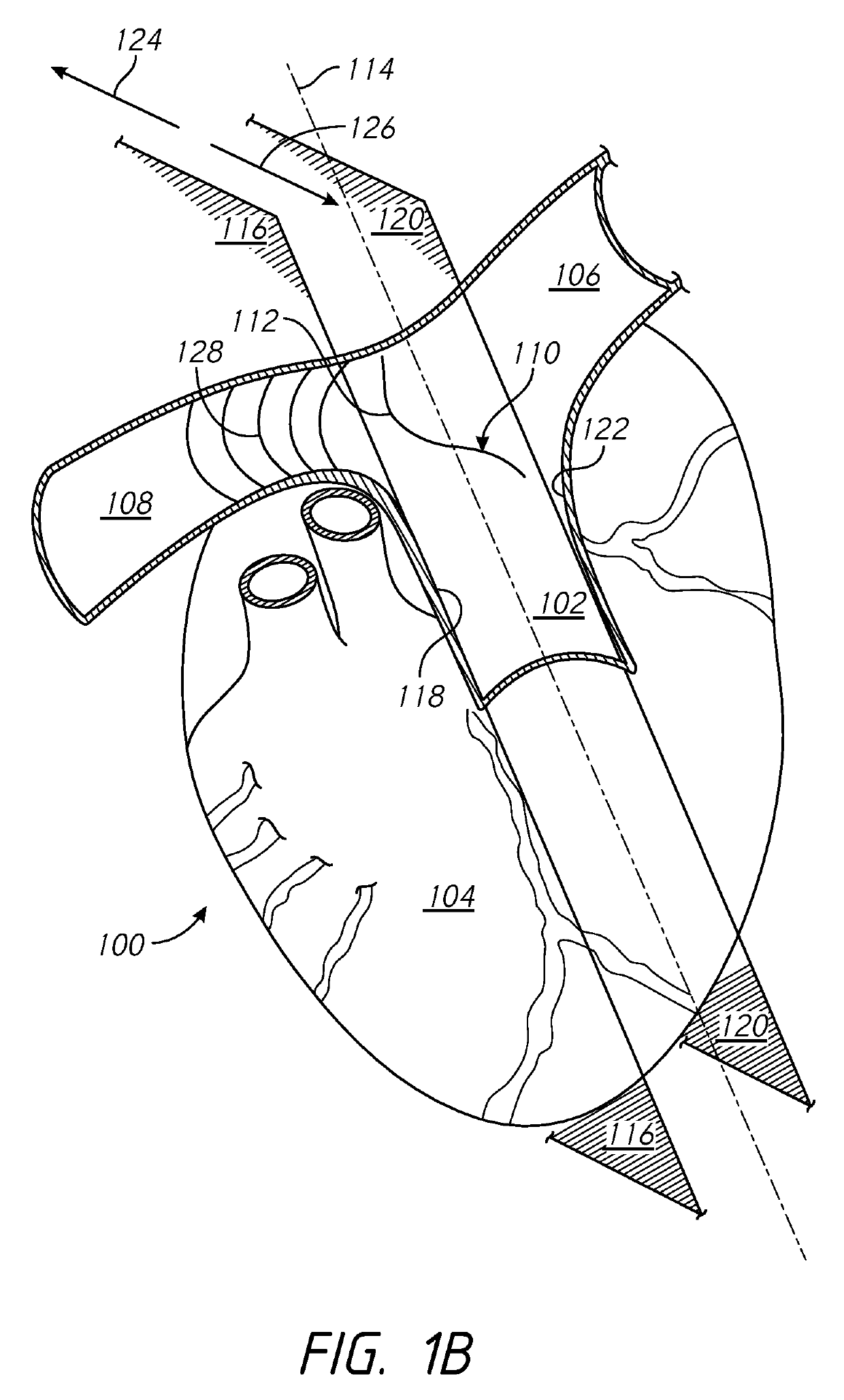 Cardiac modulation facilitation methods and systems