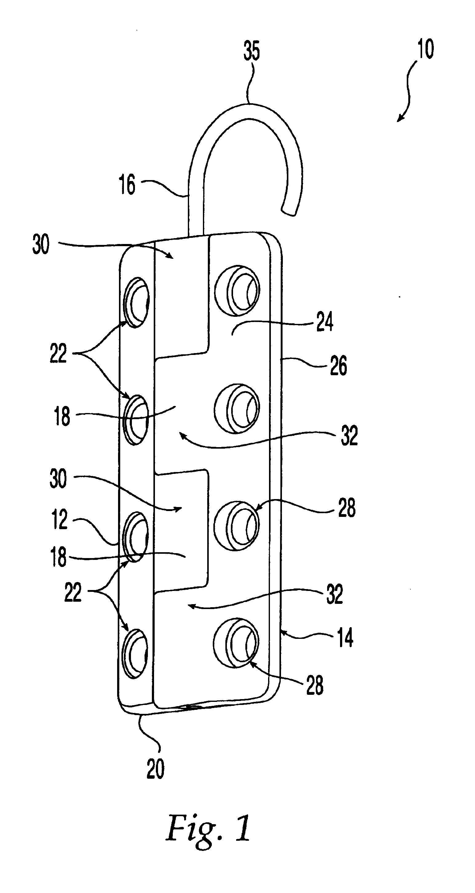 Sternum fixation device