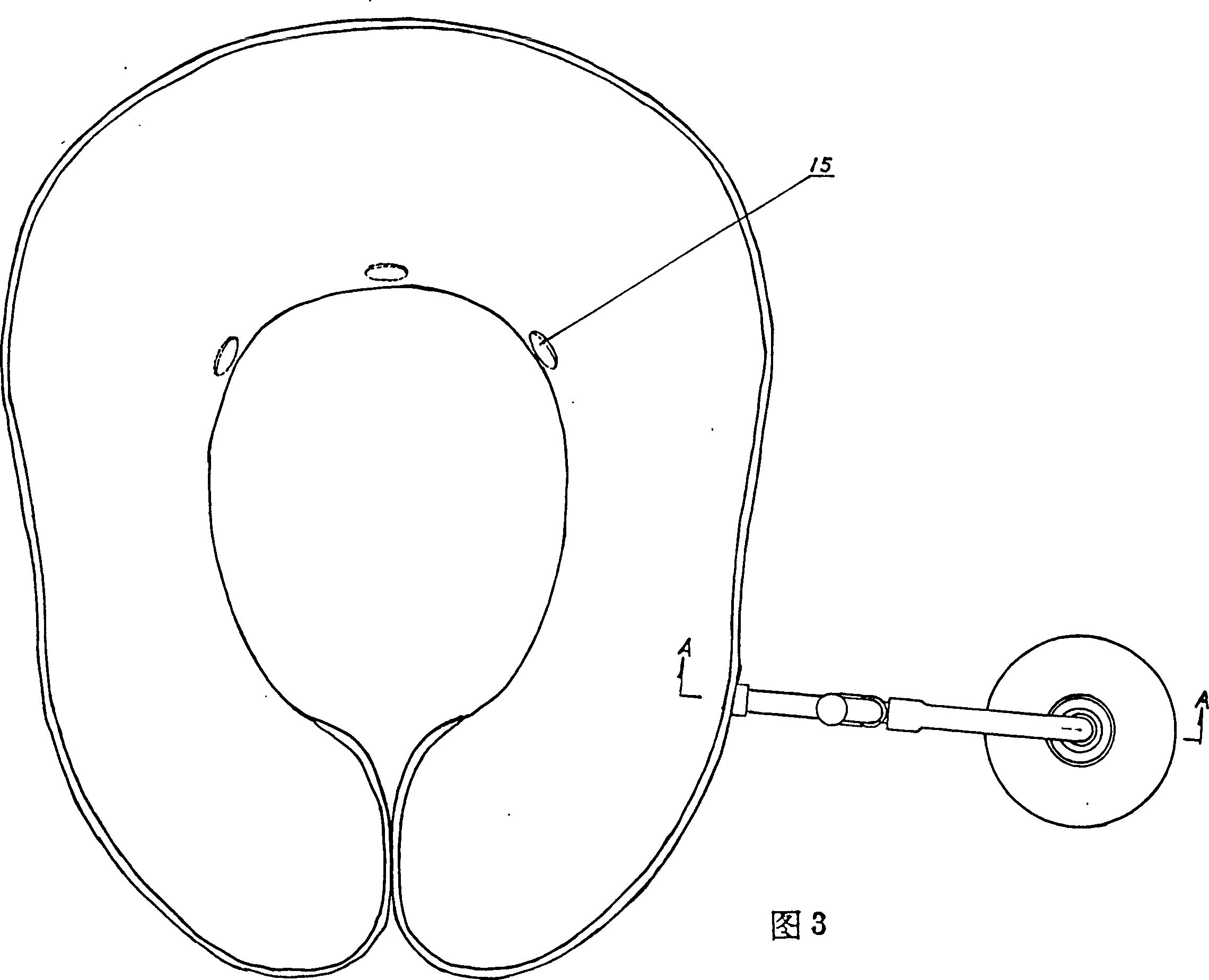 Portable fixer for magnetotherapeutic neck traction