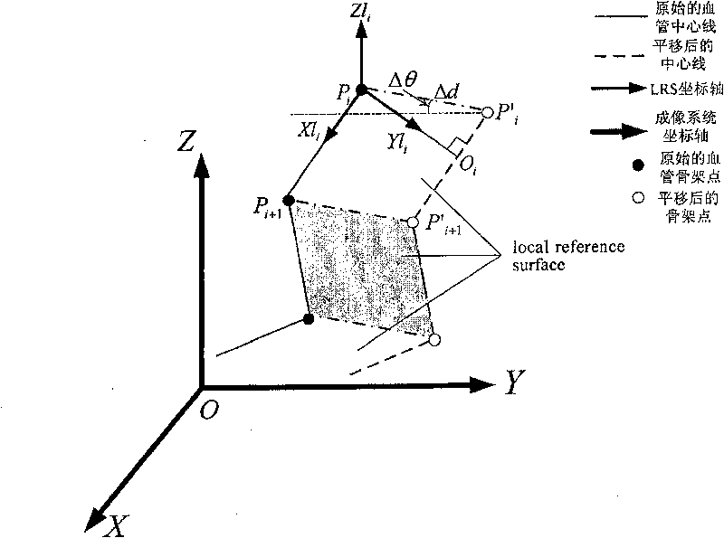 Method for obtaining the coronary artery vasomotion information