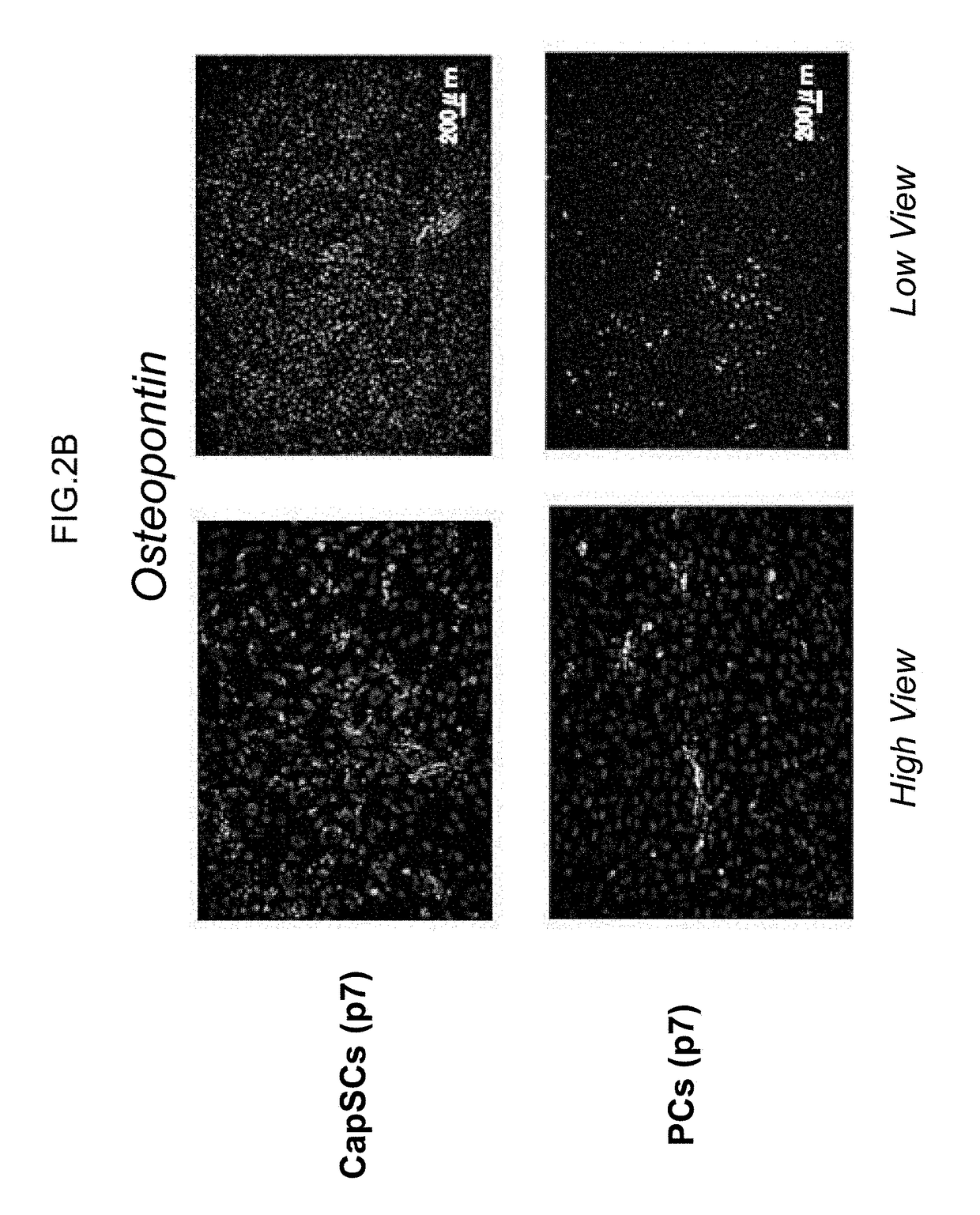 Capillary vessel-derived stem cells, use of the same, and, method for producing the same