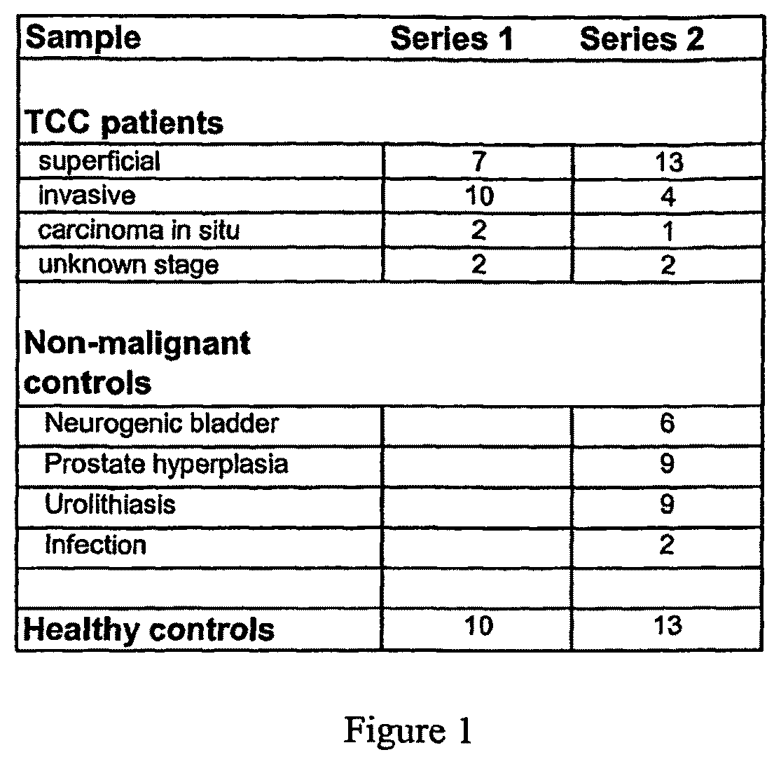 Urine markers for detection of bladder cancer