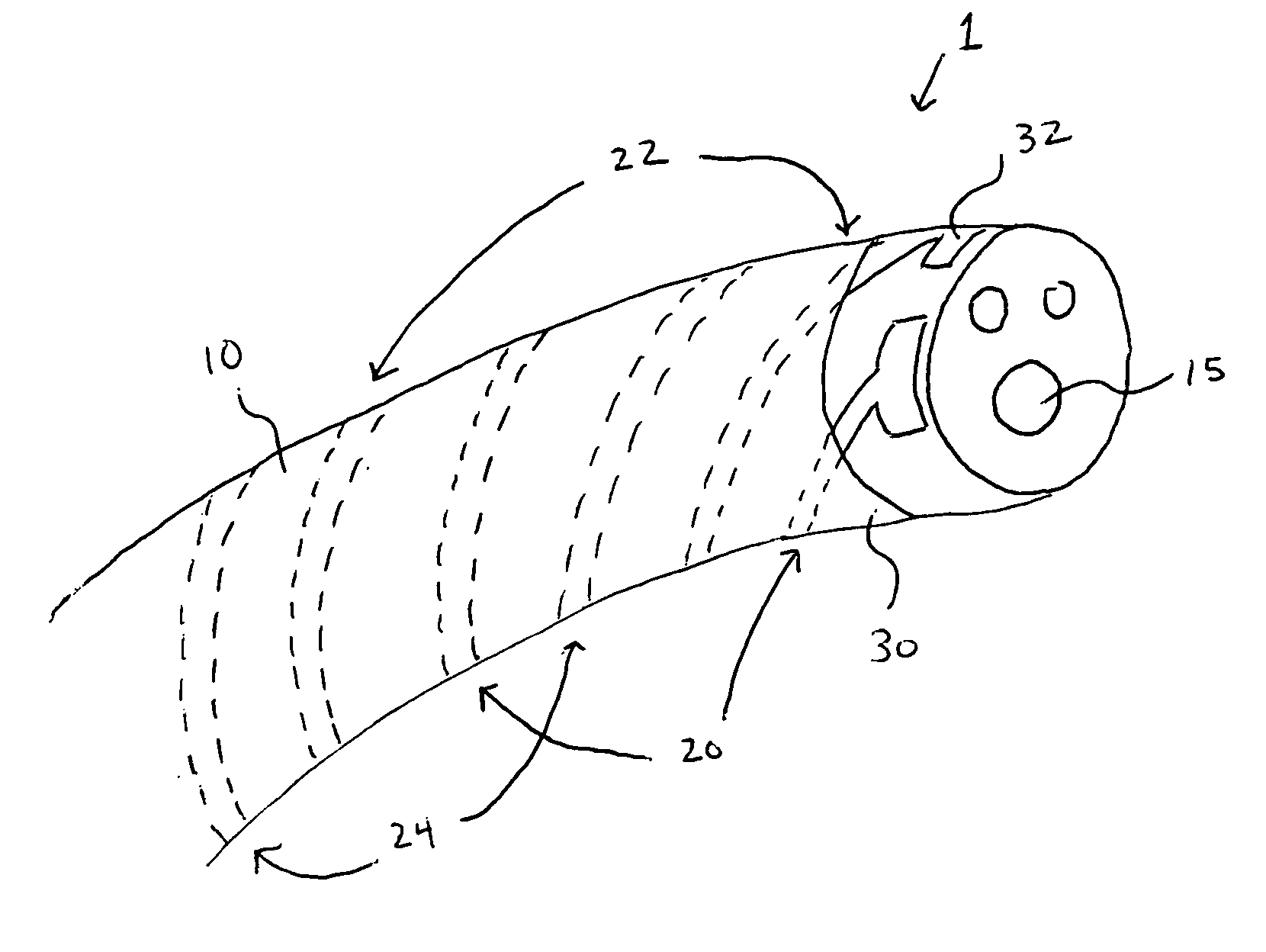 Multi-lumen catheter having external electrical leads