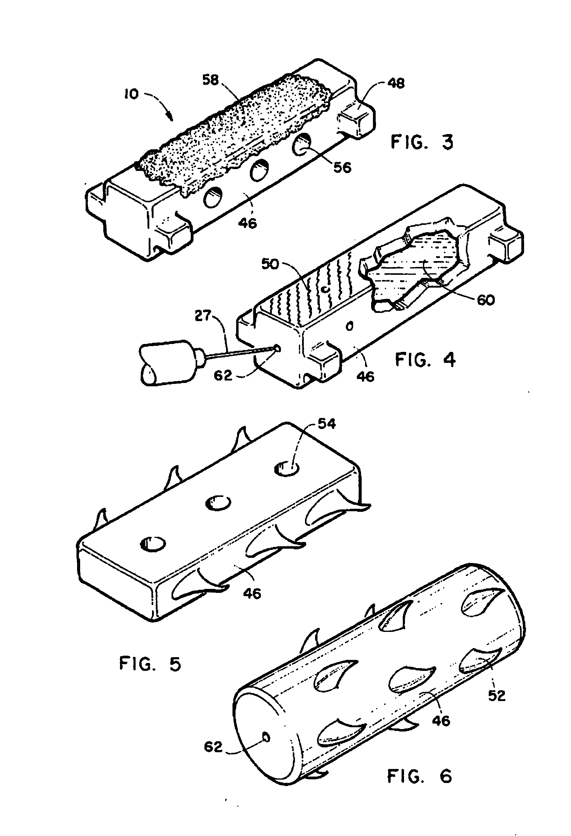 Method and intra-sclera implant for treatment of glaucoma and presbyopia