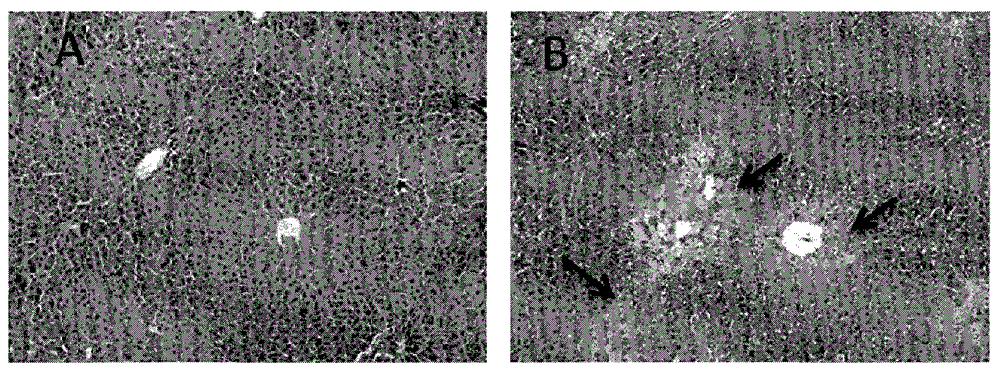 Application of fibroblast growth factor 21 to acute liver failure and alcoholic fatty livers