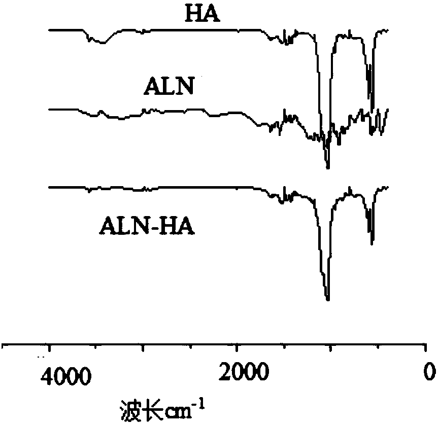 Composite type medical biological bone cement, preparation method and application thereof