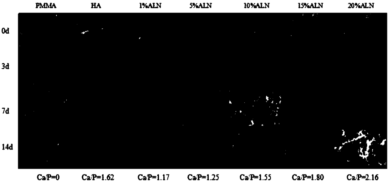 Composite type medical biological bone cement, preparation method and application thereof