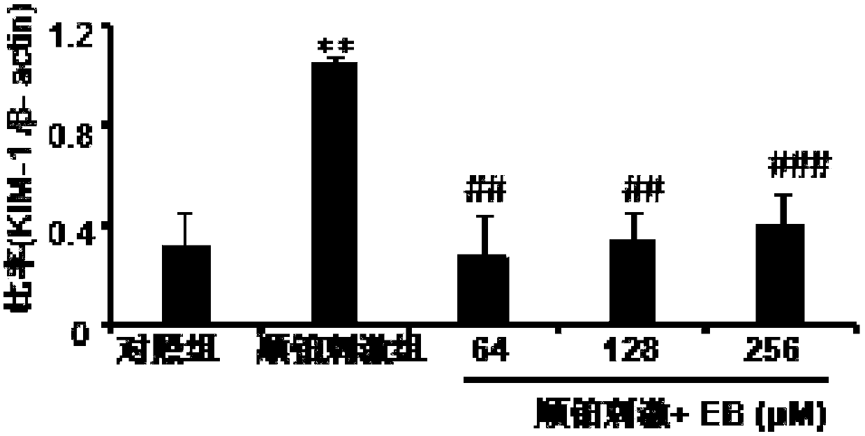 Application of eleutheroside B in preparation of medicine for preventing or treating acute kidney injury