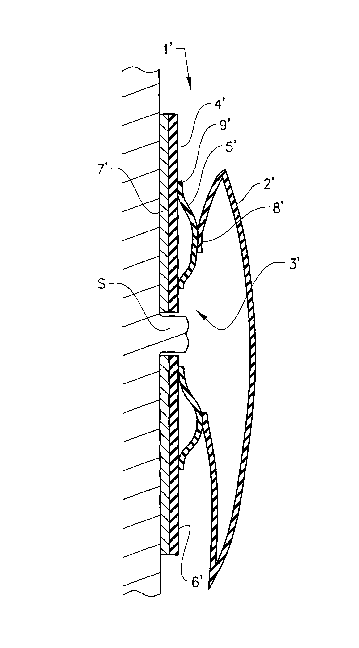 Ostomy device