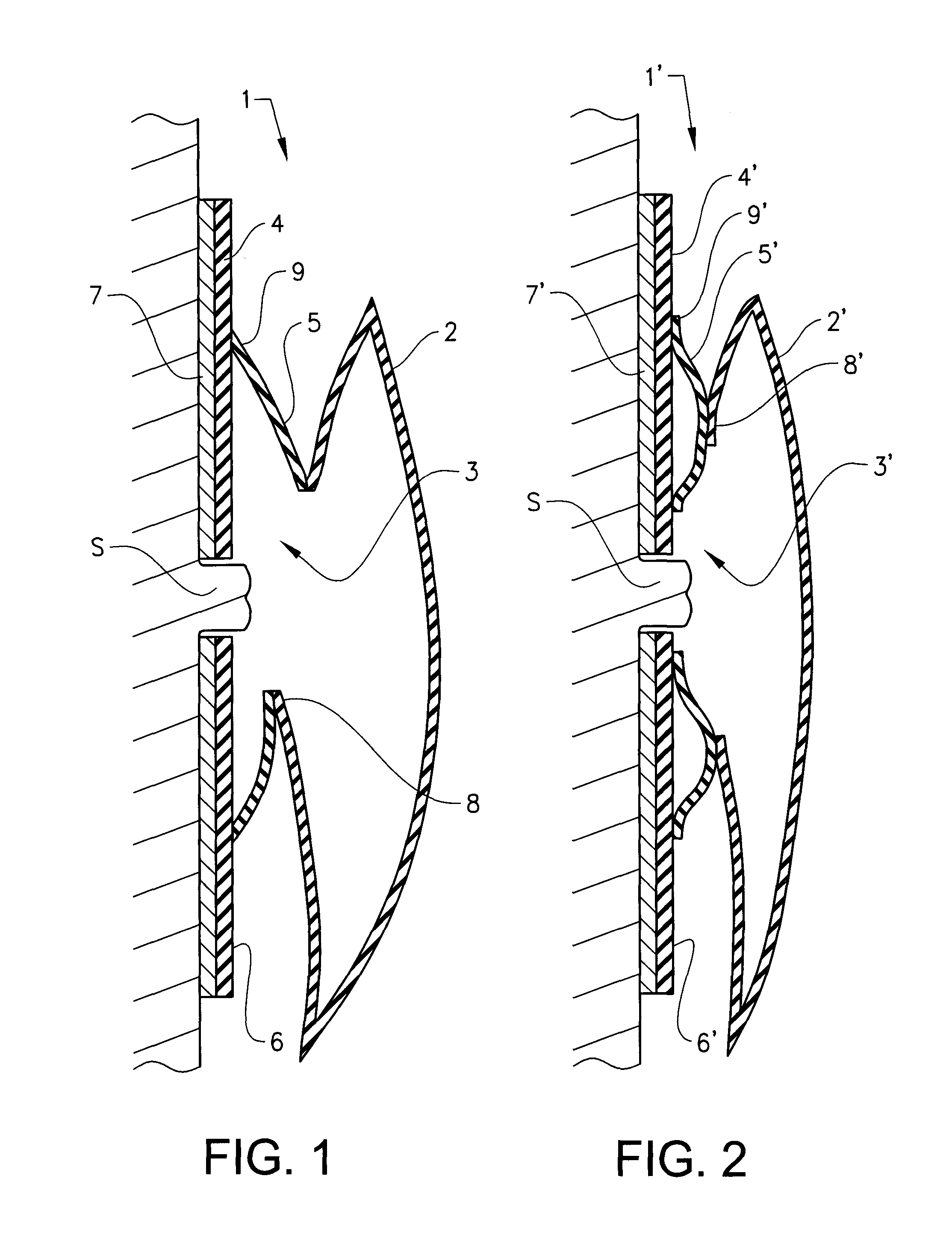 Ostomy device