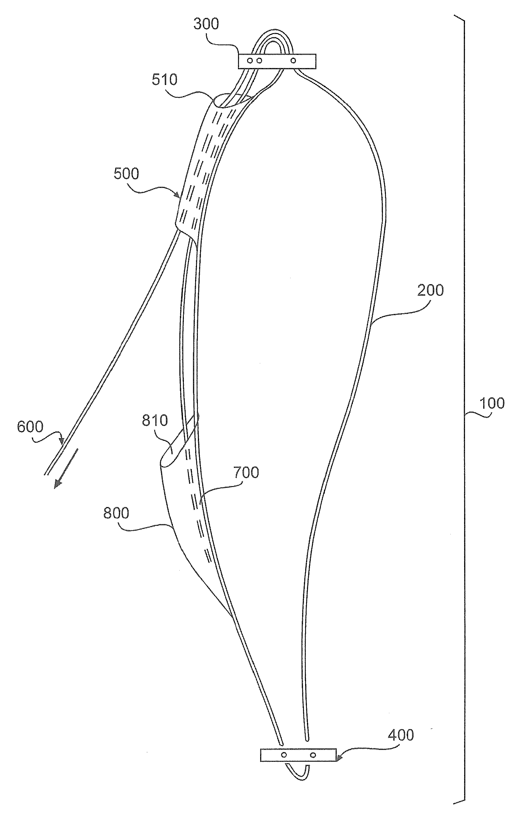 Adjustable Suture Lock Loop