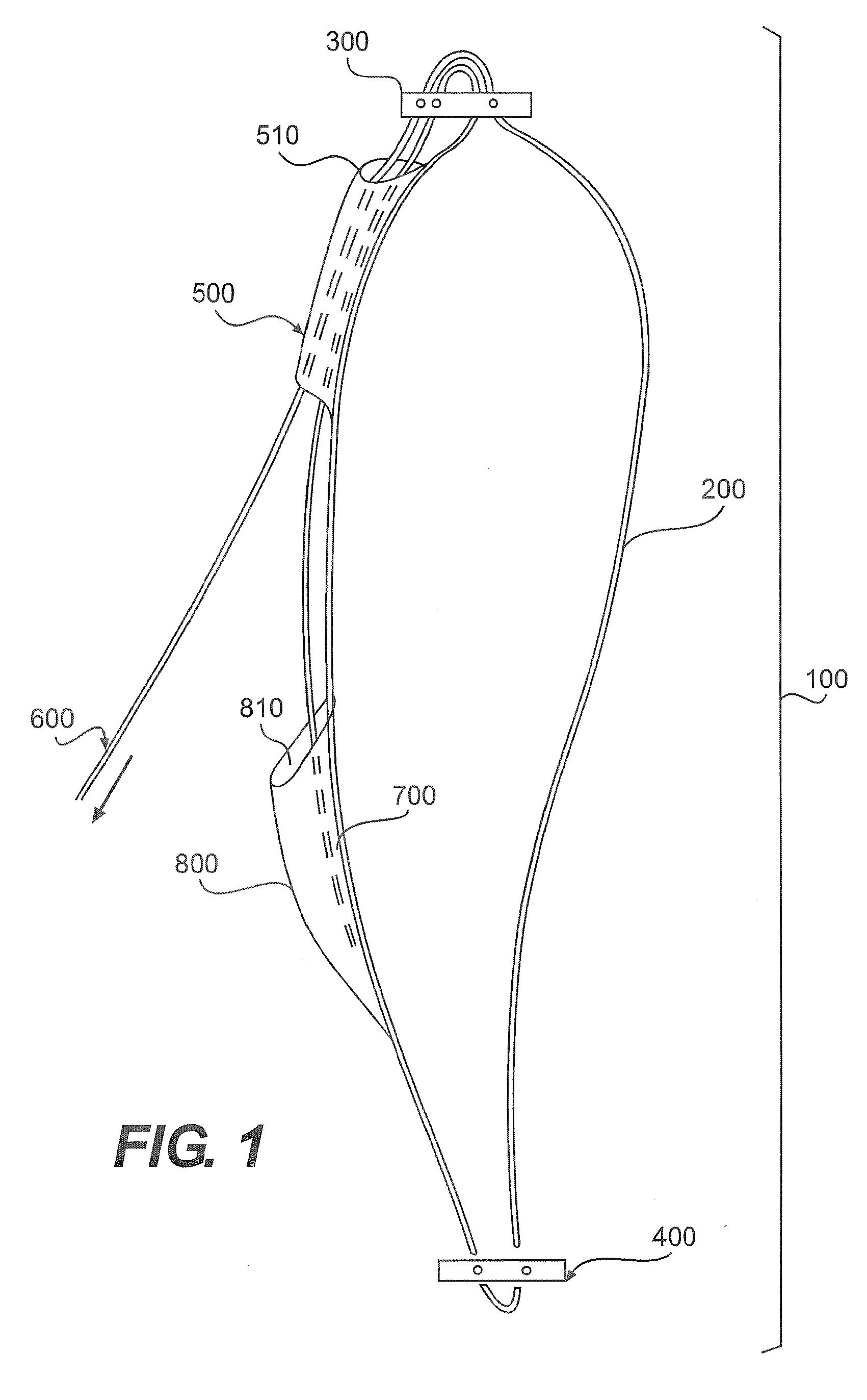 Adjustable Suture Lock Loop