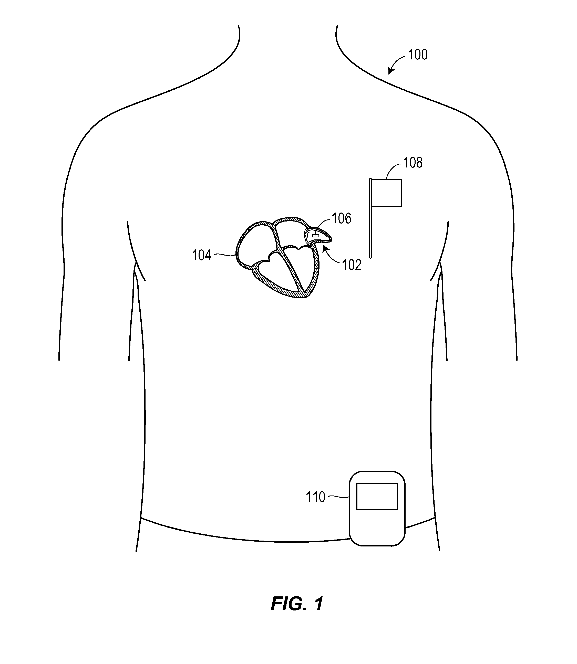 Multimodality left atrial appendage occlusion device