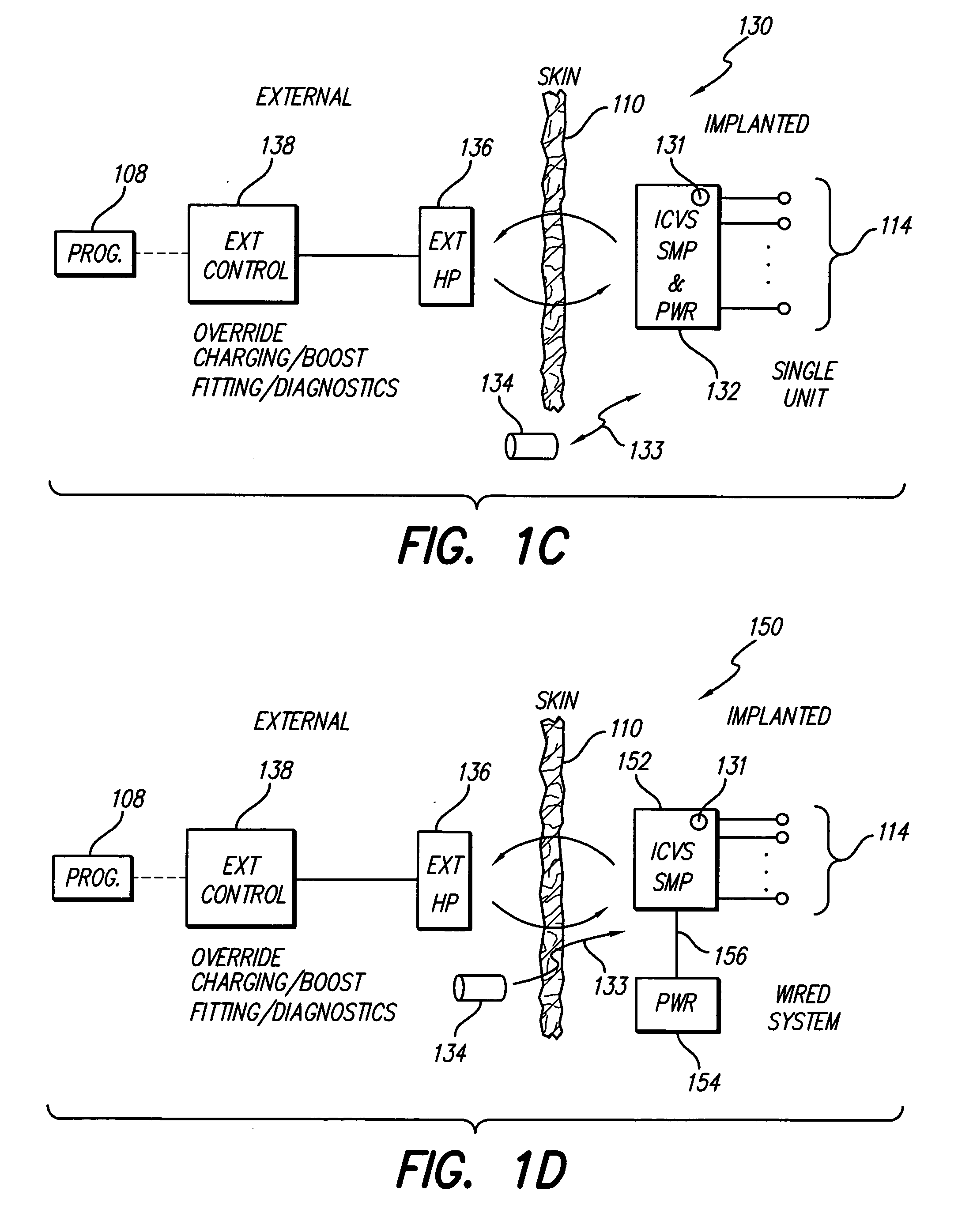 Hybrid cochlear/vestibular implant