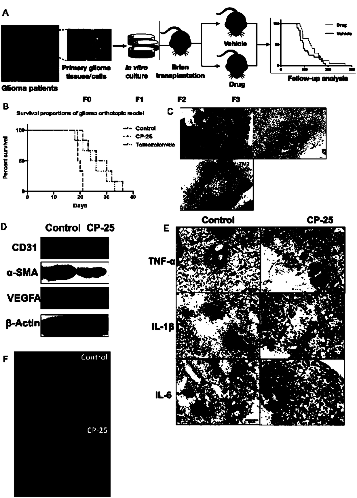 Application of paeoniflorin derivative CP-25