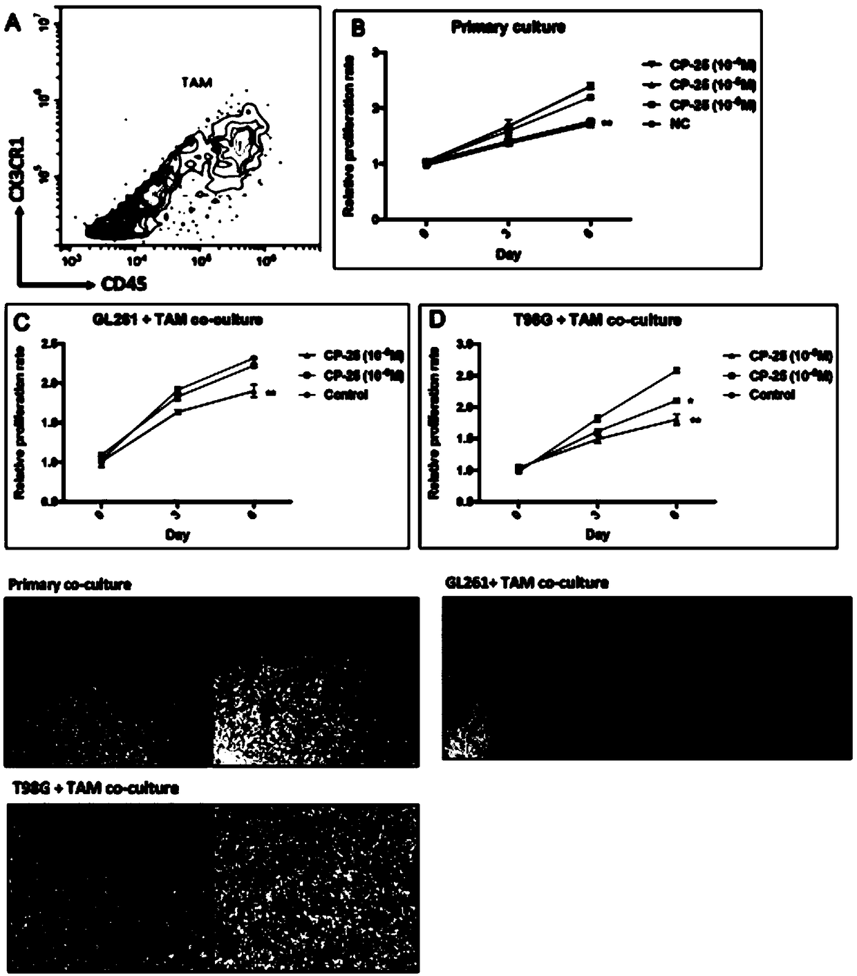 Application of paeoniflorin derivative CP-25