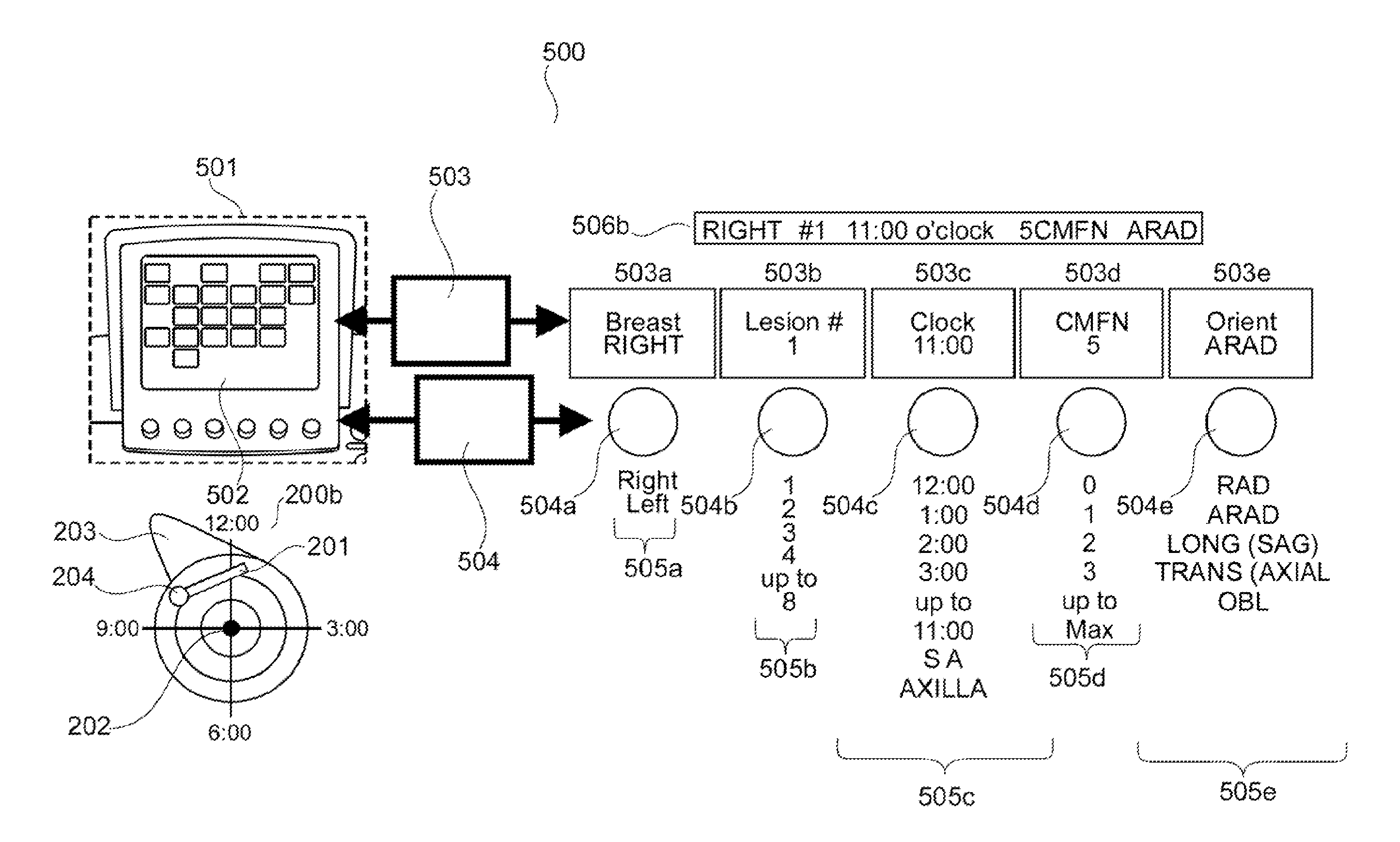 Breast ultrasound annotation user interface