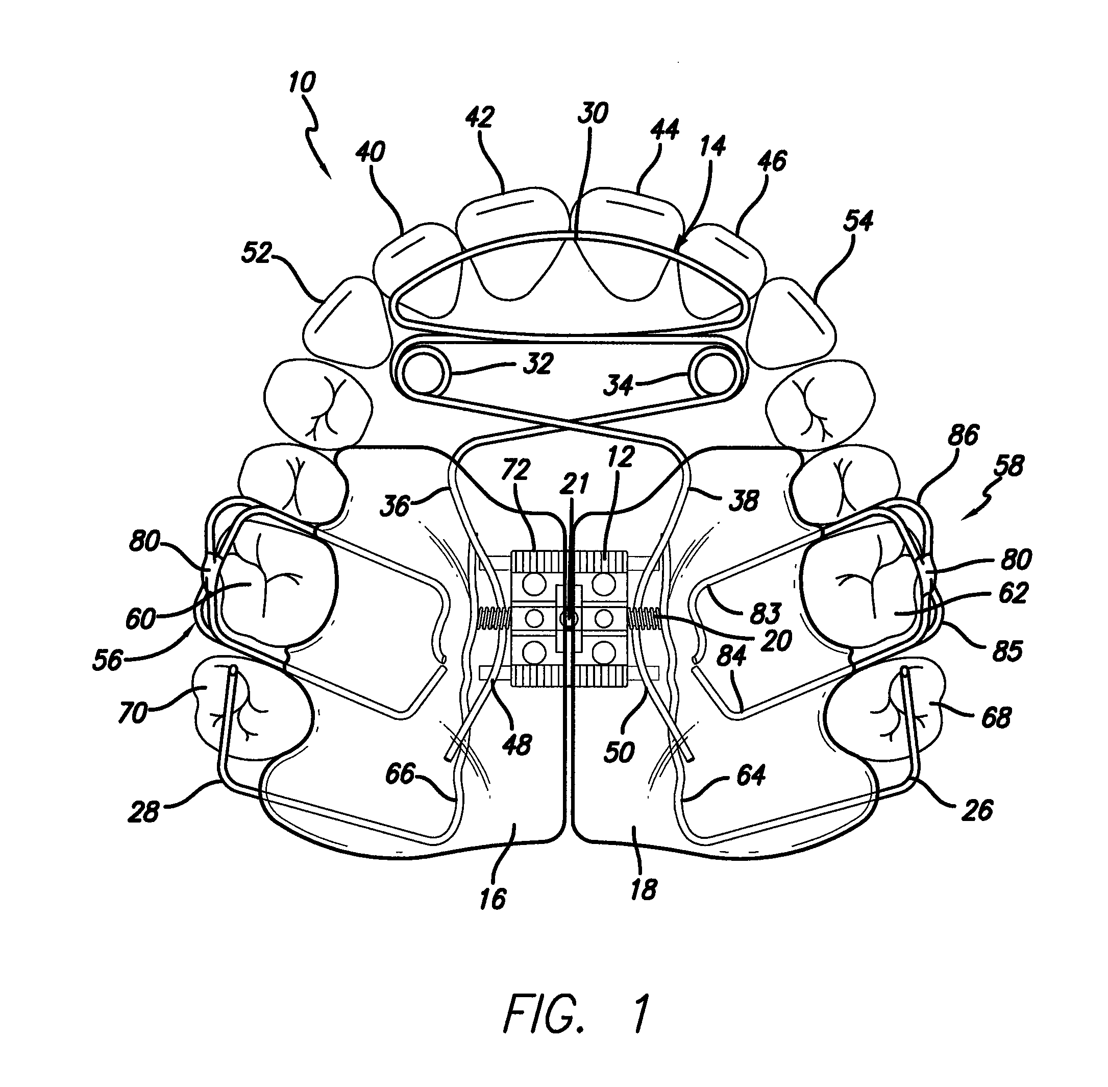 Maxillary expansion and advancement orthodontic applicance