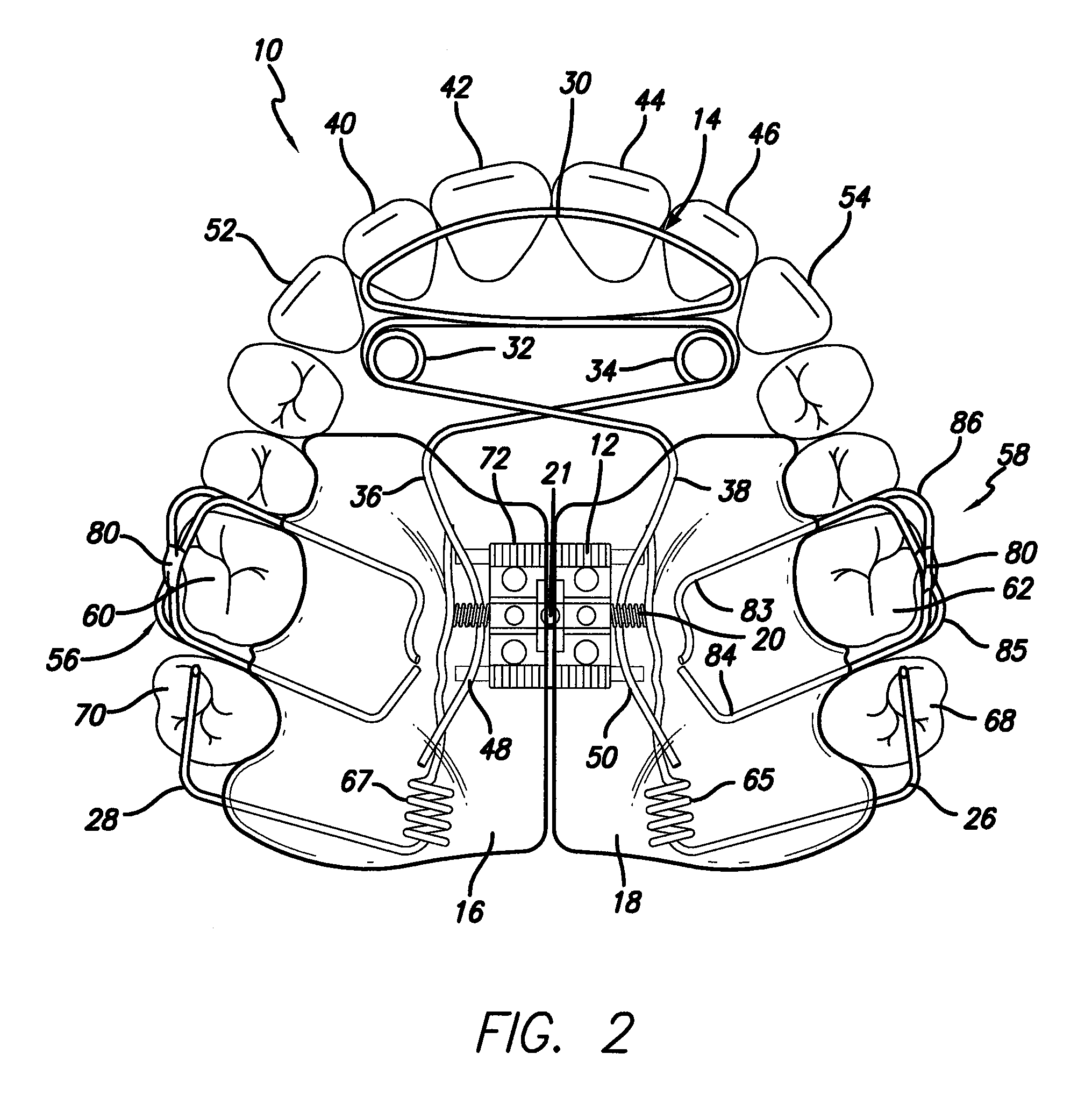 Maxillary expansion and advancement orthodontic applicance