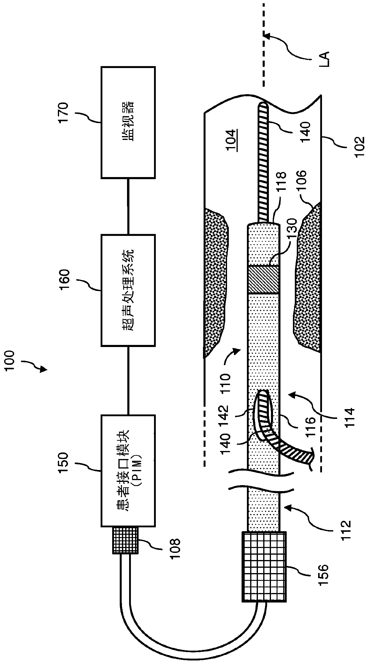 Digital rotational patient interface module