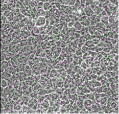 Cell preparation for treating osteoarthritis and preparation method thereof